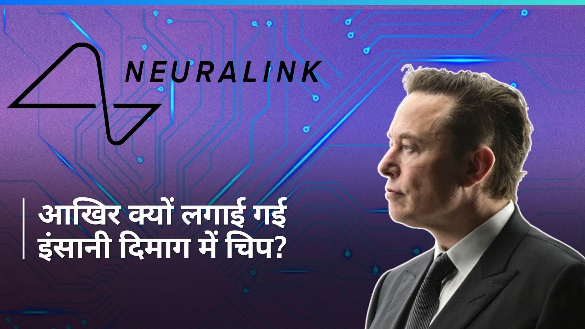Elon Musk: एलन मस्क की कंपनी ने इंसानी दिमाग में लगाई चिप, जानिए क्यों किया गया टेस्ट