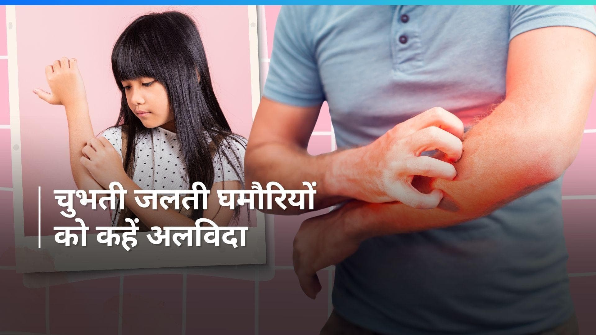 Prickly Heat Rash: गर्मी में बच्चों को हो जाती हैं घमौरियां? इन टिप्स को आज ही नोट कर लें माता-पिता