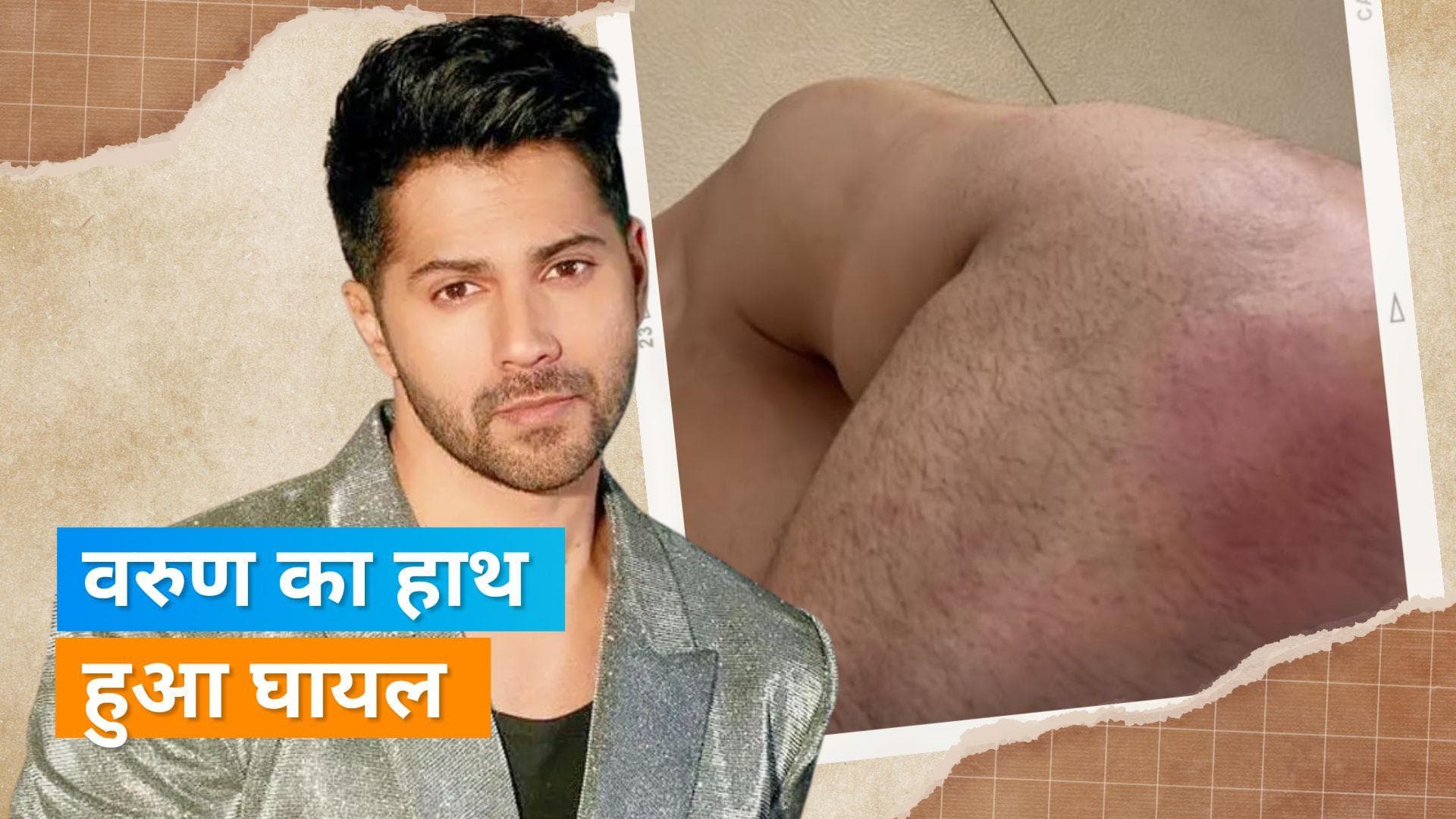  Varun Dhawan को लगी चोट, फैंस के साथ शेयर की फोटो