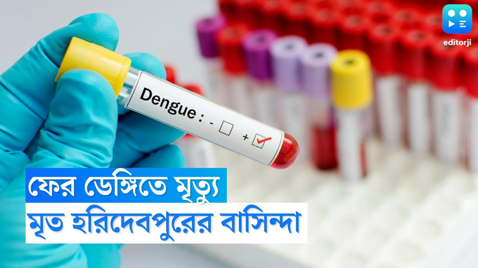 Dengue Death in Kolkata: কলকাতায় ফের ডেঙ্গির থাবা, মৃত হরিদেবপুরের প্রৌঢ়া