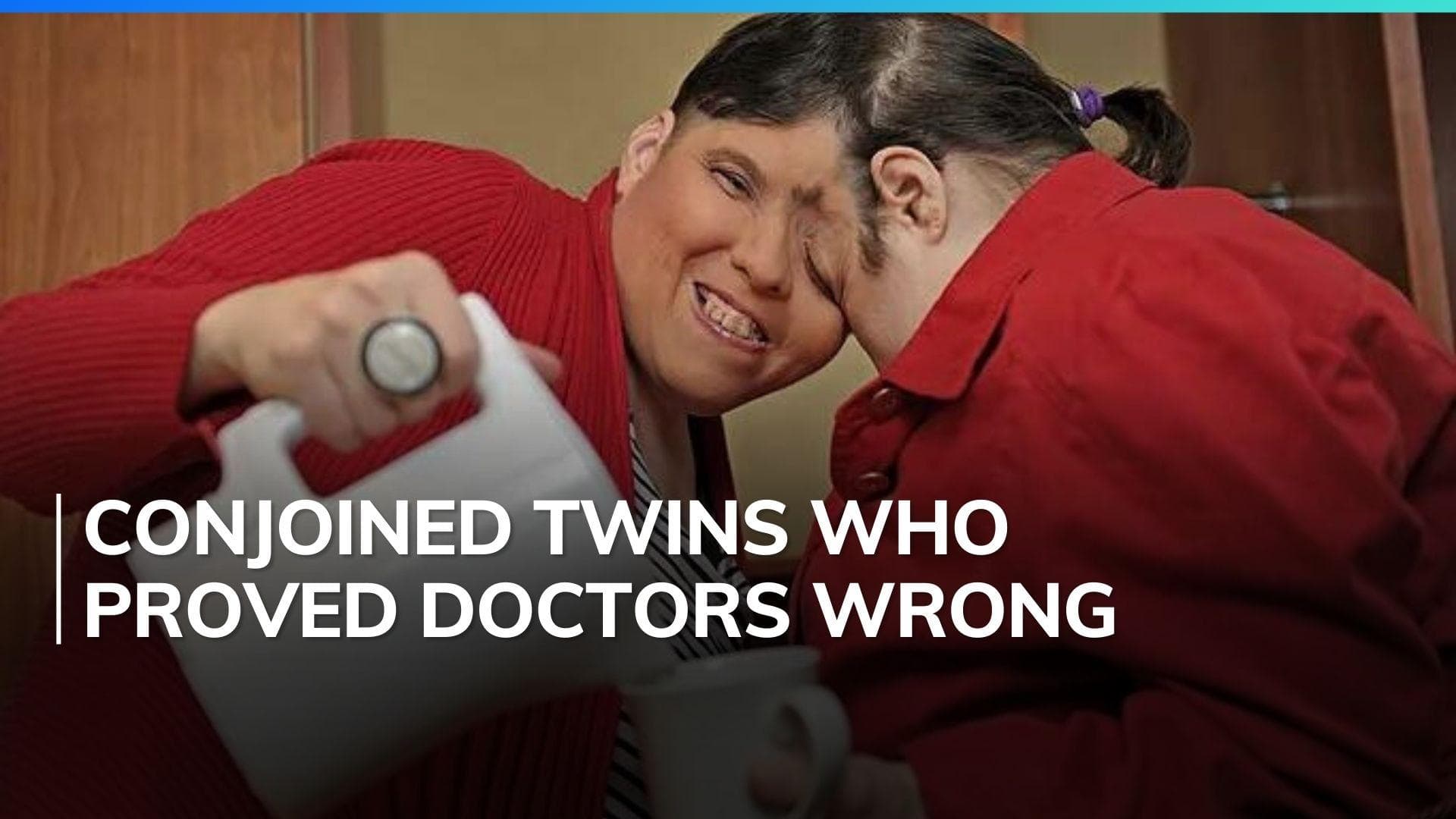 Lori and George Schappell, the oldest living conjoined twins have died