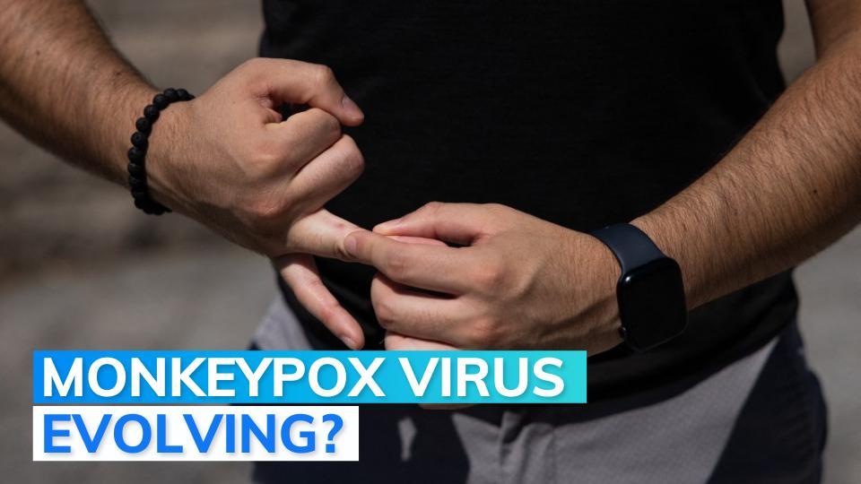 British Medical Journal: current Monkeypox symptoms different from earlier outbreaks