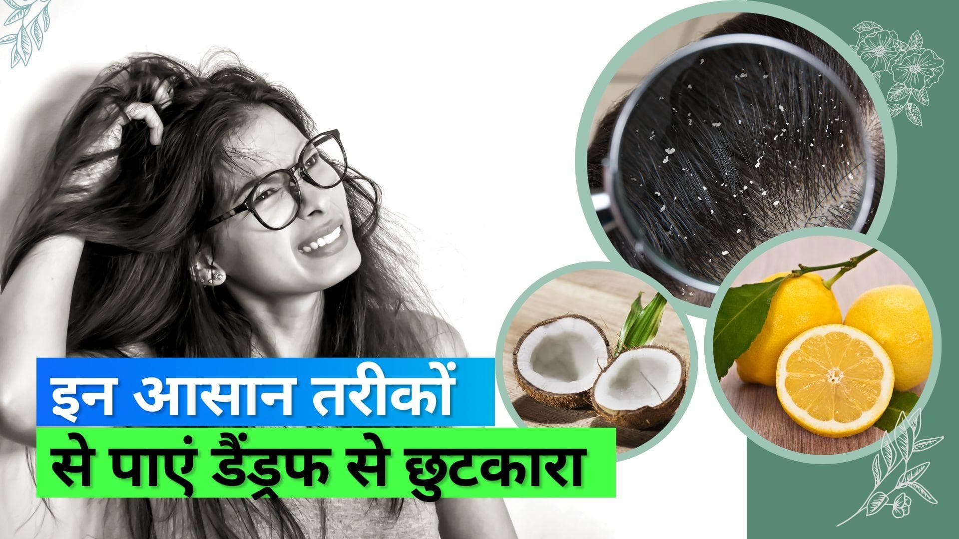 Winter Hair Care: सर्दियों में डैंडरफ से छुटकारा पाने के लिए आज़माएं ये घरेलू नुस्खे