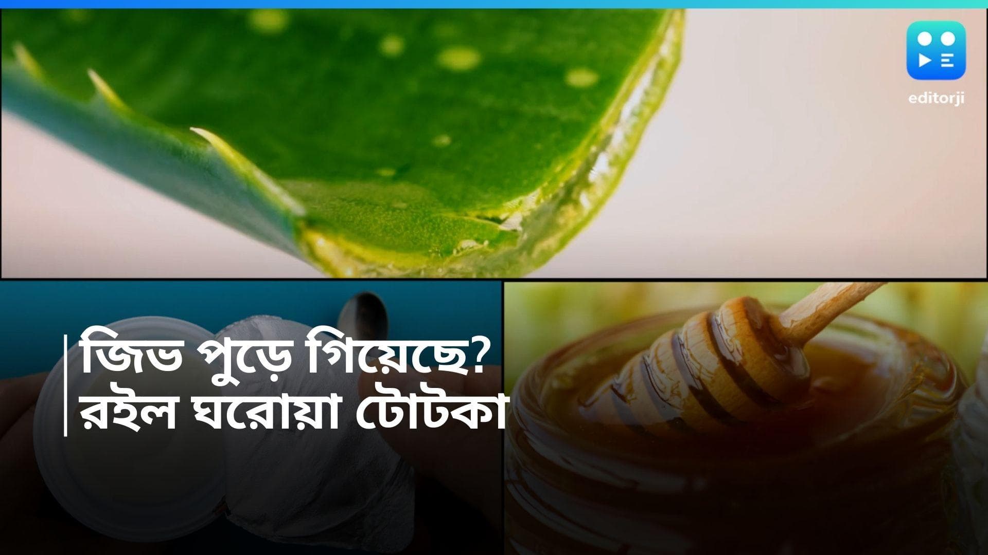  চা-কফি খেতে গিয়ে জিভ পুড়ে গিয়েছে, রইল জ্বালা ভাব থেকে মুক্তি পাওয়ার ঘরোয়া উপায় 