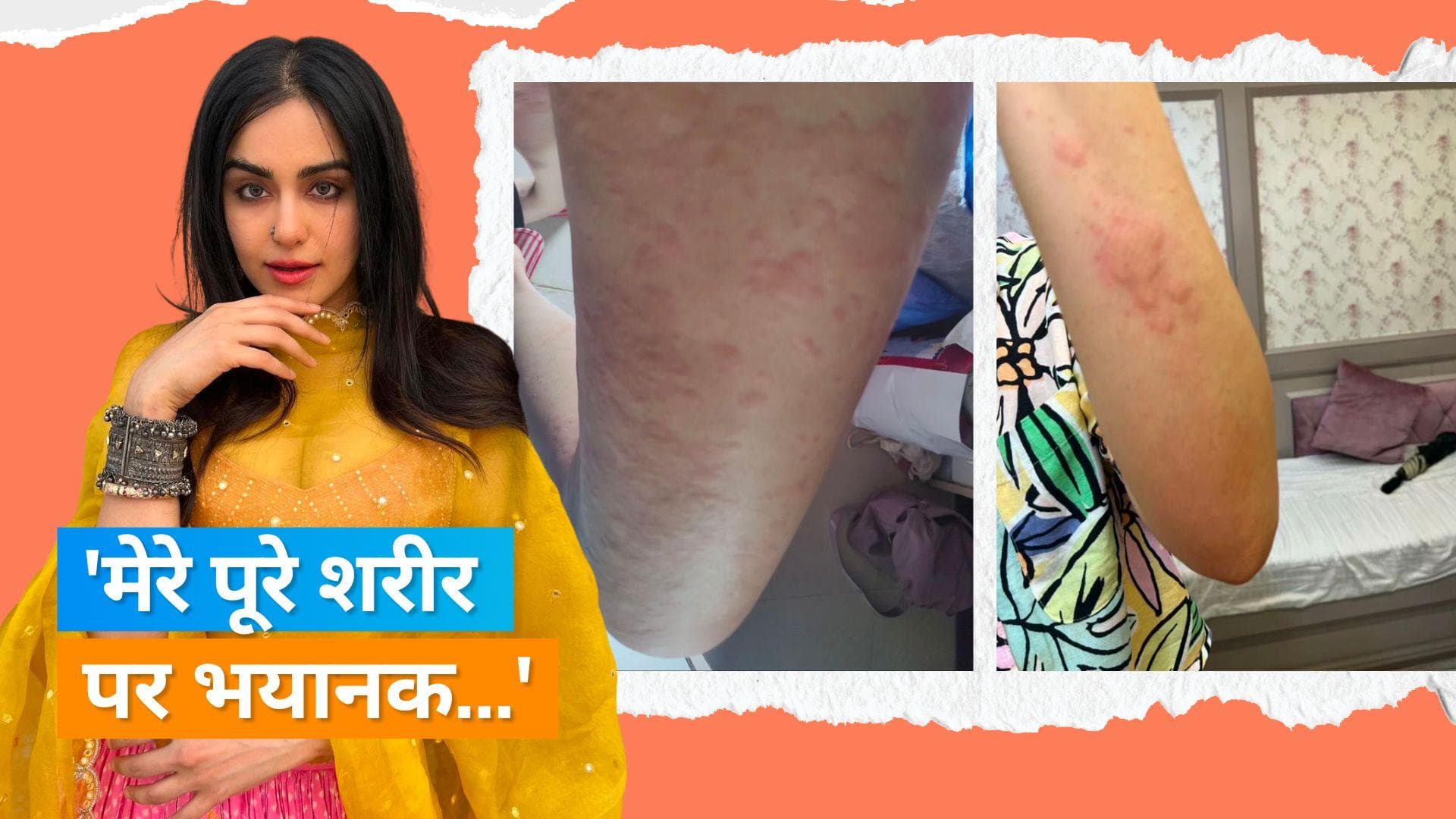 Adah Sharma ने अपने हेल्थ को लेकर किया बड़ा खुलासा, इस बड़ी बीमारी से परेशान हैं एक्ट्रेस