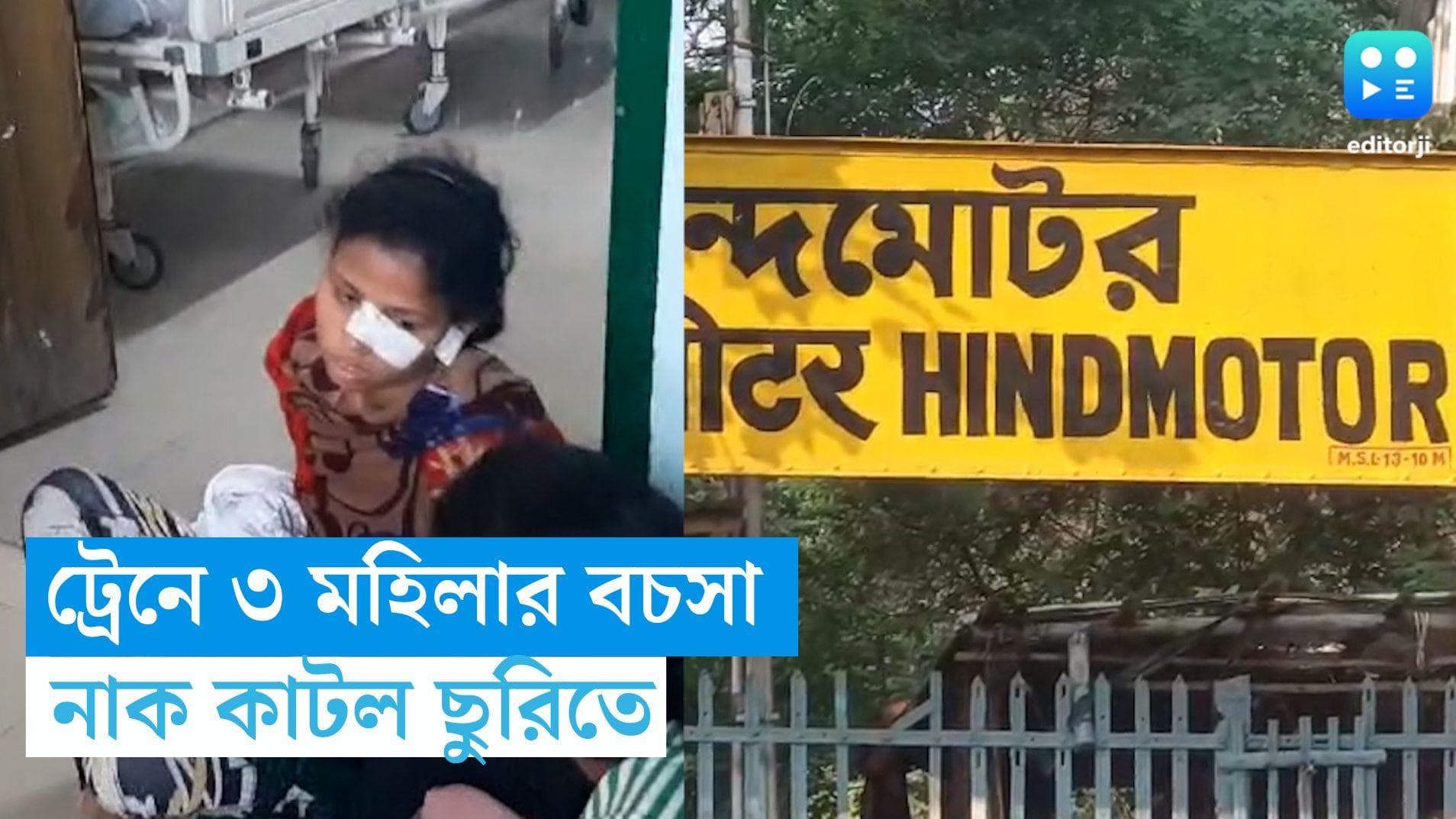 Local Train-Hooghly: ৩ মহিলার তুমুল ঝগড়া, নাক কাটল ছুরিতে! তুলকালাম কাণ্ড এই স্টেশনে