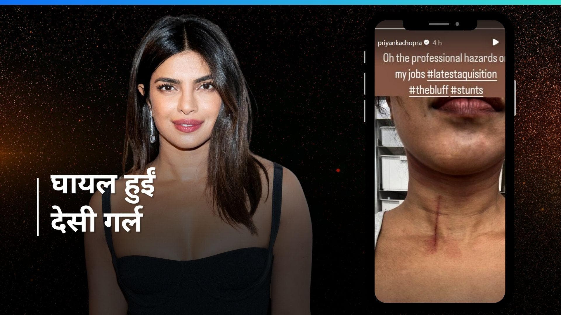 Priyanka Chopra: स्टंट सीन करते सेट पर घायल हुईं देसी गर्ल, गर्दन पर दिखा कट का बड़ा निशान