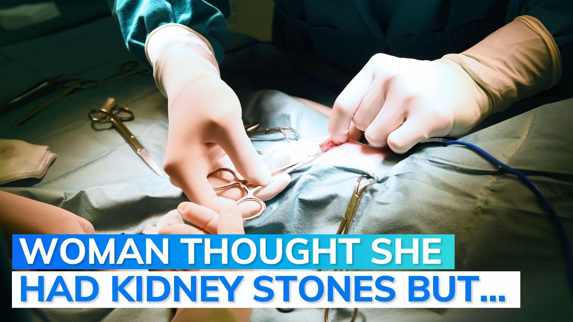 Kerala: forceps removed from woman's stomach, left inside during a surgery... 5 years ago