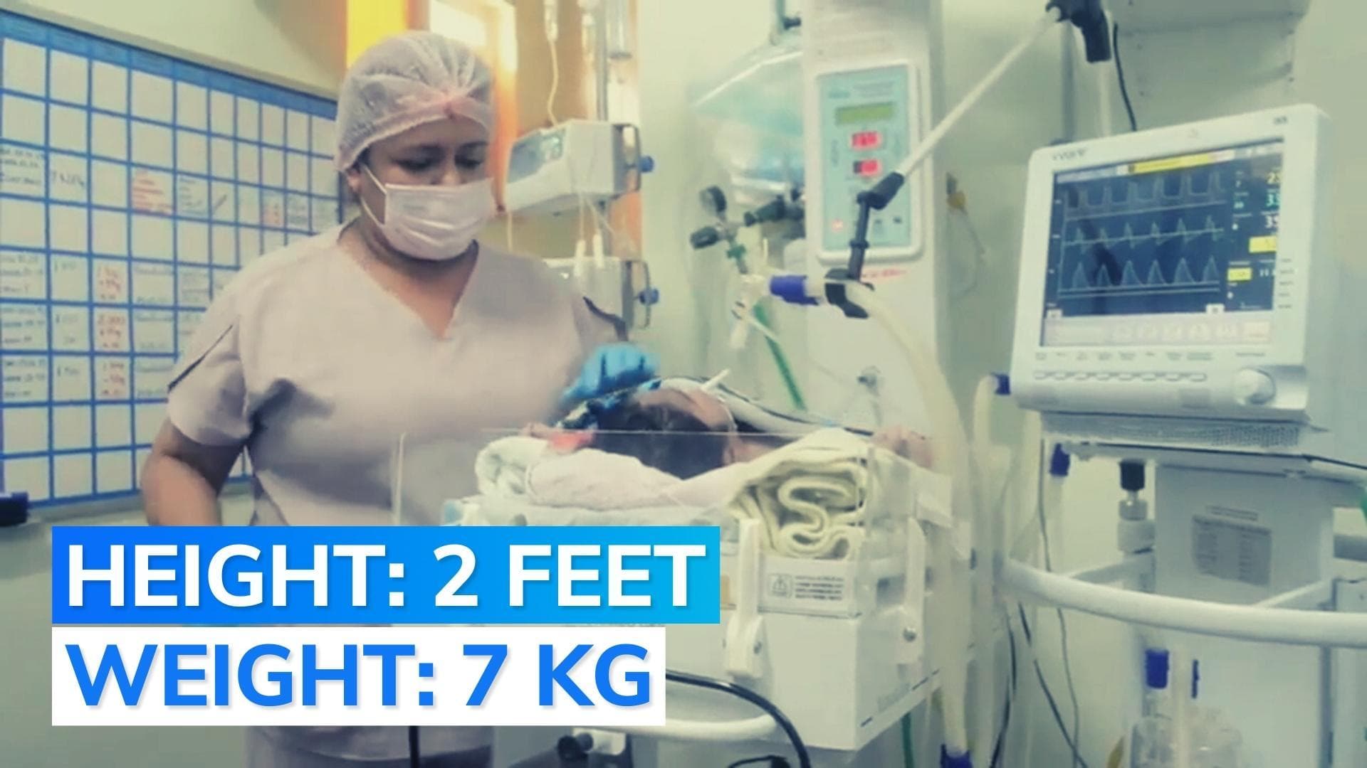 Baby weighing 7 kg born in Brazil. Here's what can cause 'macrosomia'