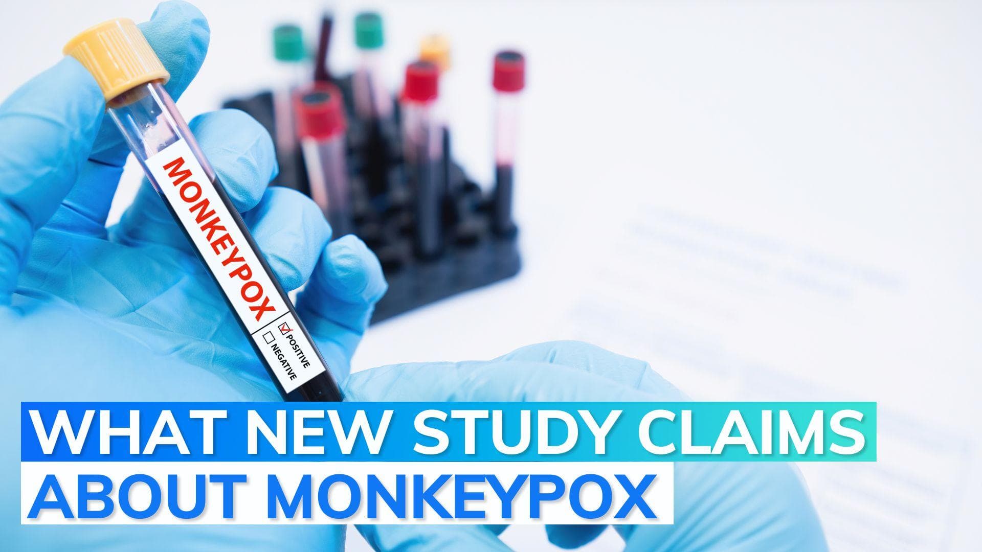 Scientists find evidence of 'substantial' transmission of monkeypox even before symptoms appear