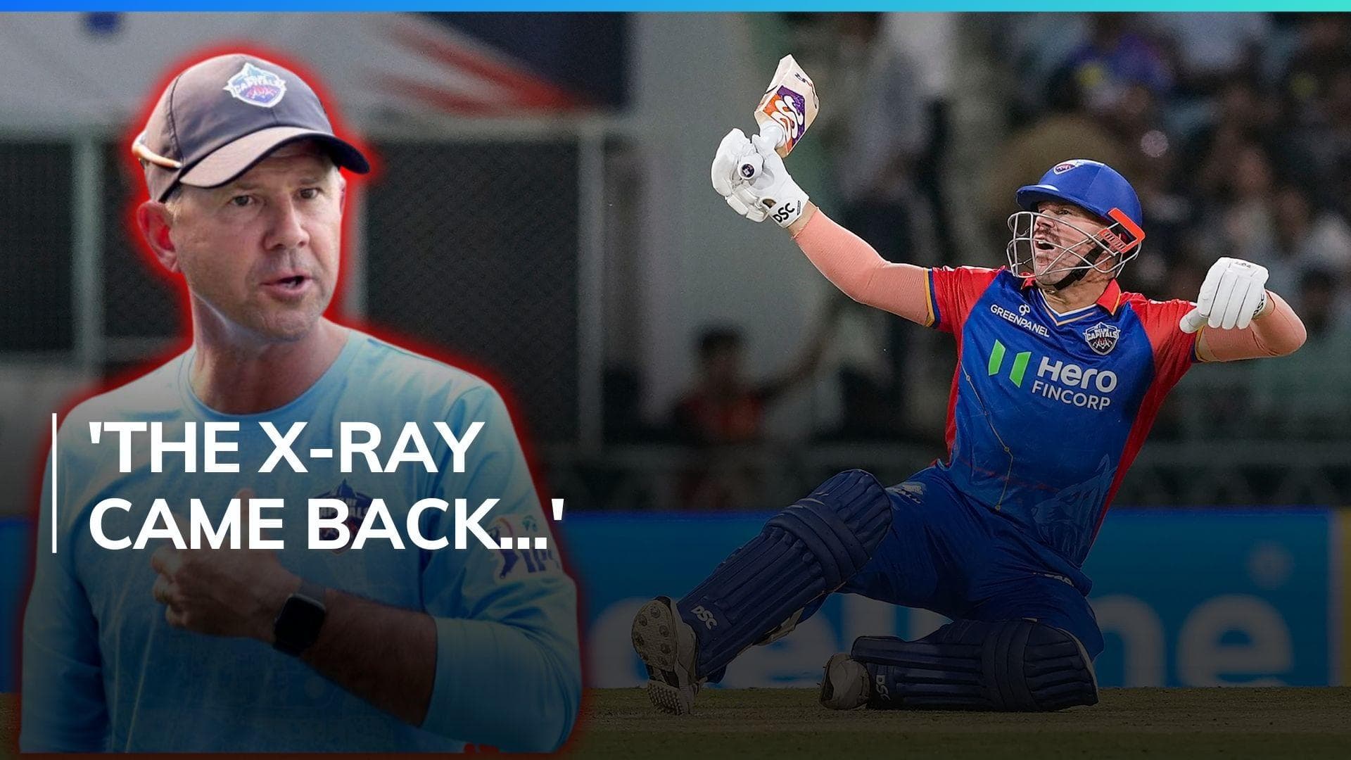 David Warner doubtful for Delhi Capitals' clash against Gujarat Titans | IPL 2024, GT vs DC