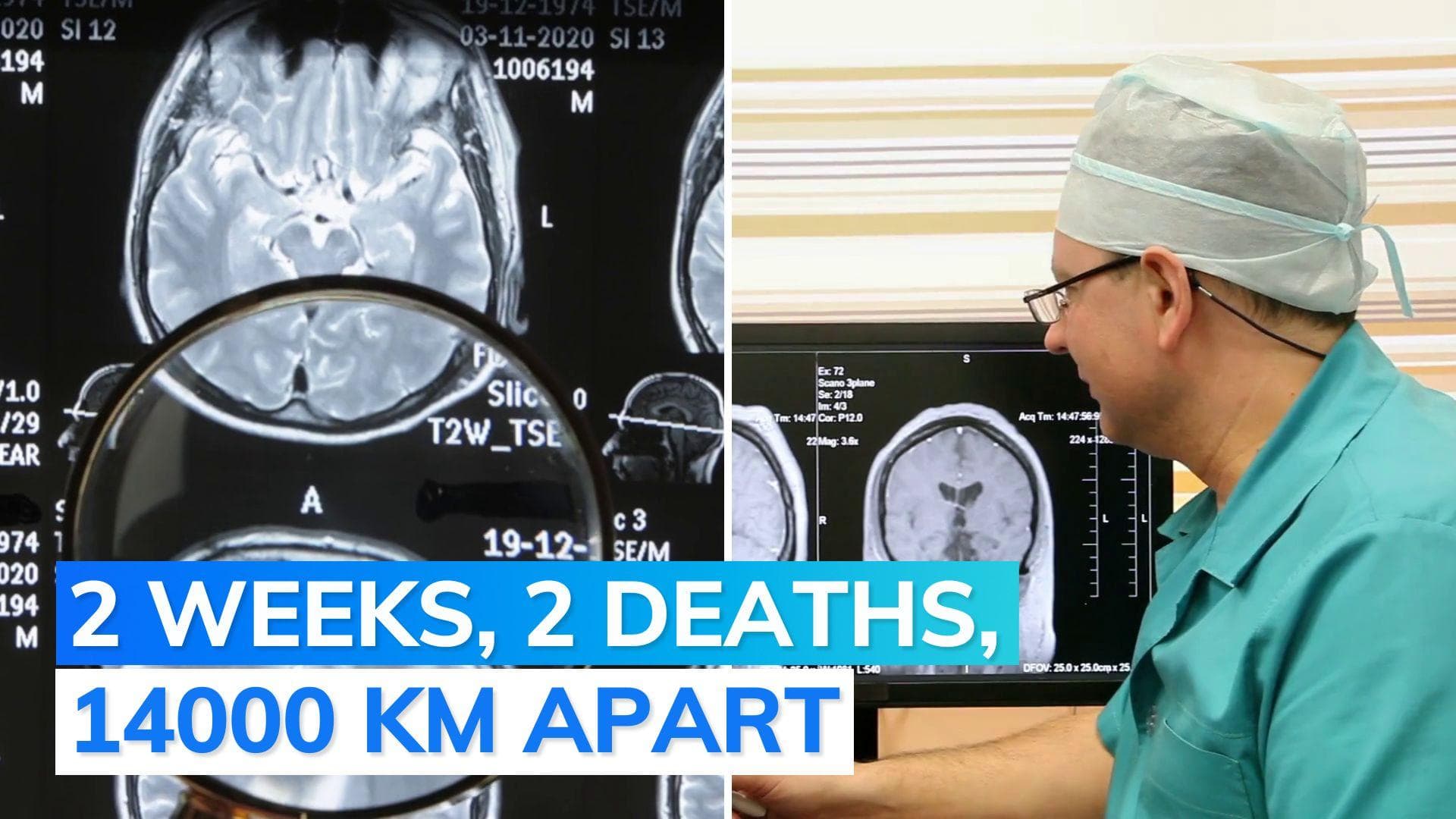 After Kerala boy, US toddler killed by 'brain-eating amoeba'