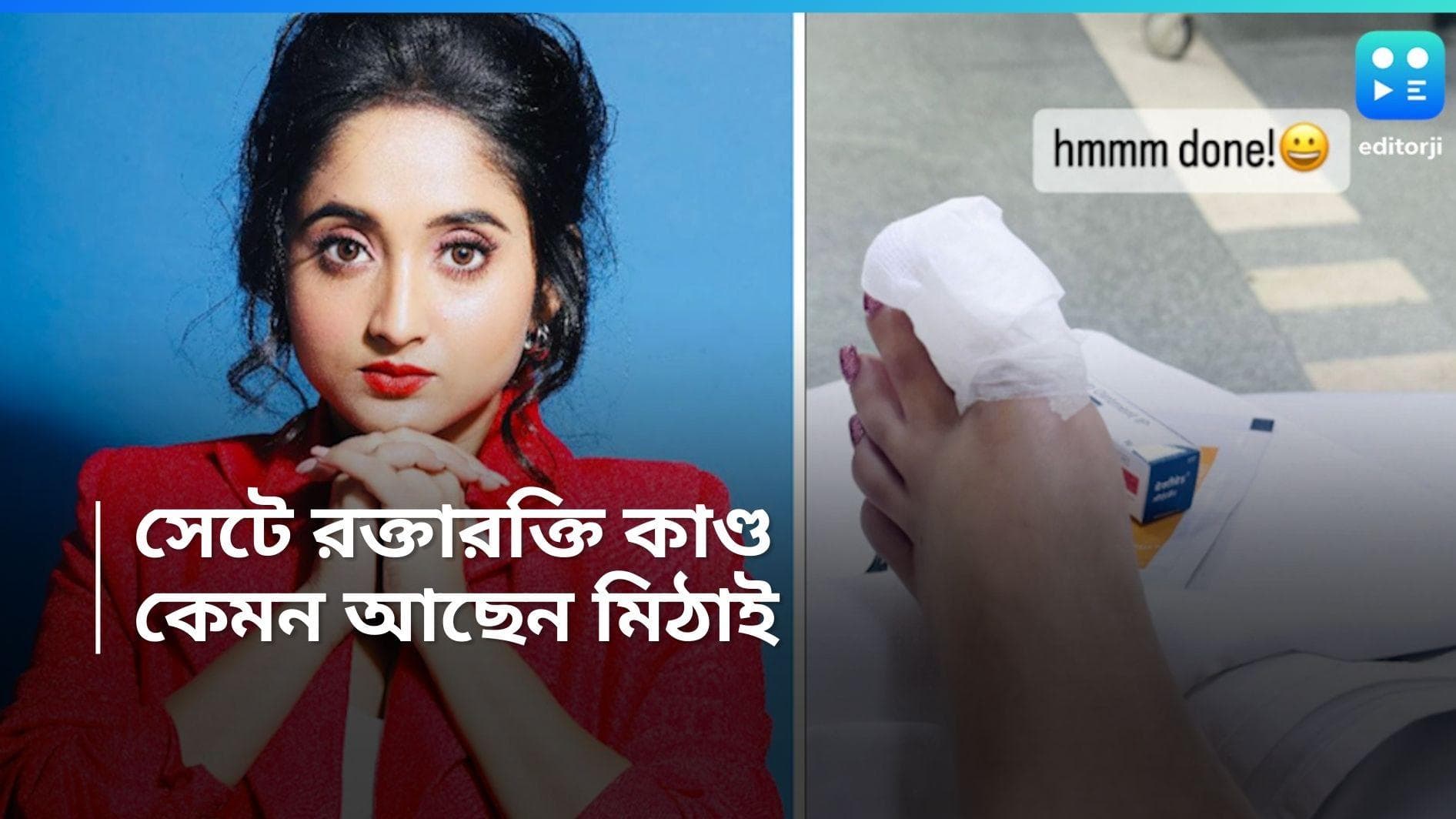 Soumitrisha Kundu Accident : শুটিং সেটে রক্তারক্তি কাণ্ড, কেমন আছেন পর্দার মিঠাইরানীর? 