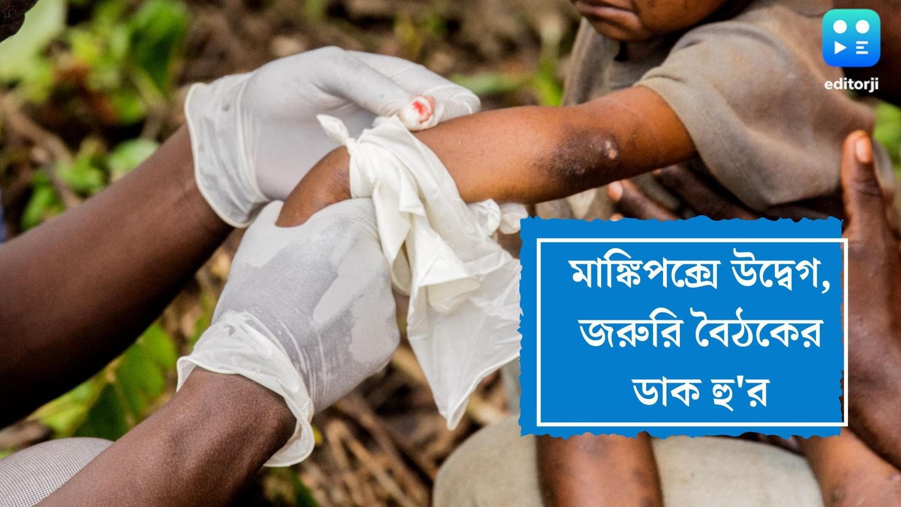 WHO on Monkeypox: এবার উদ্বেগ বাড়াচ্ছে মাঙ্কিপক্স, জরুরি বৈঠক ডাকল হু