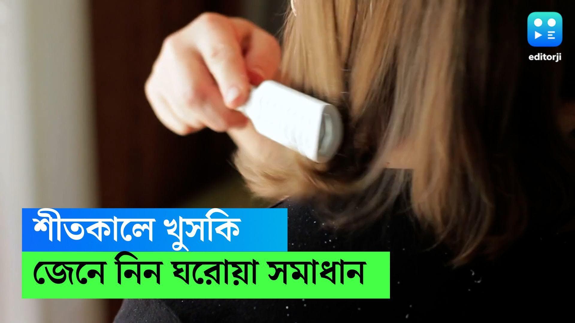 Dandruff removal tips : দামী শ্যাম্পু ব্যবহার করেও মিটছে না খুশকির সমস্যা ? শীতে মেনে চলুন ঘরোয়া টোটকা 