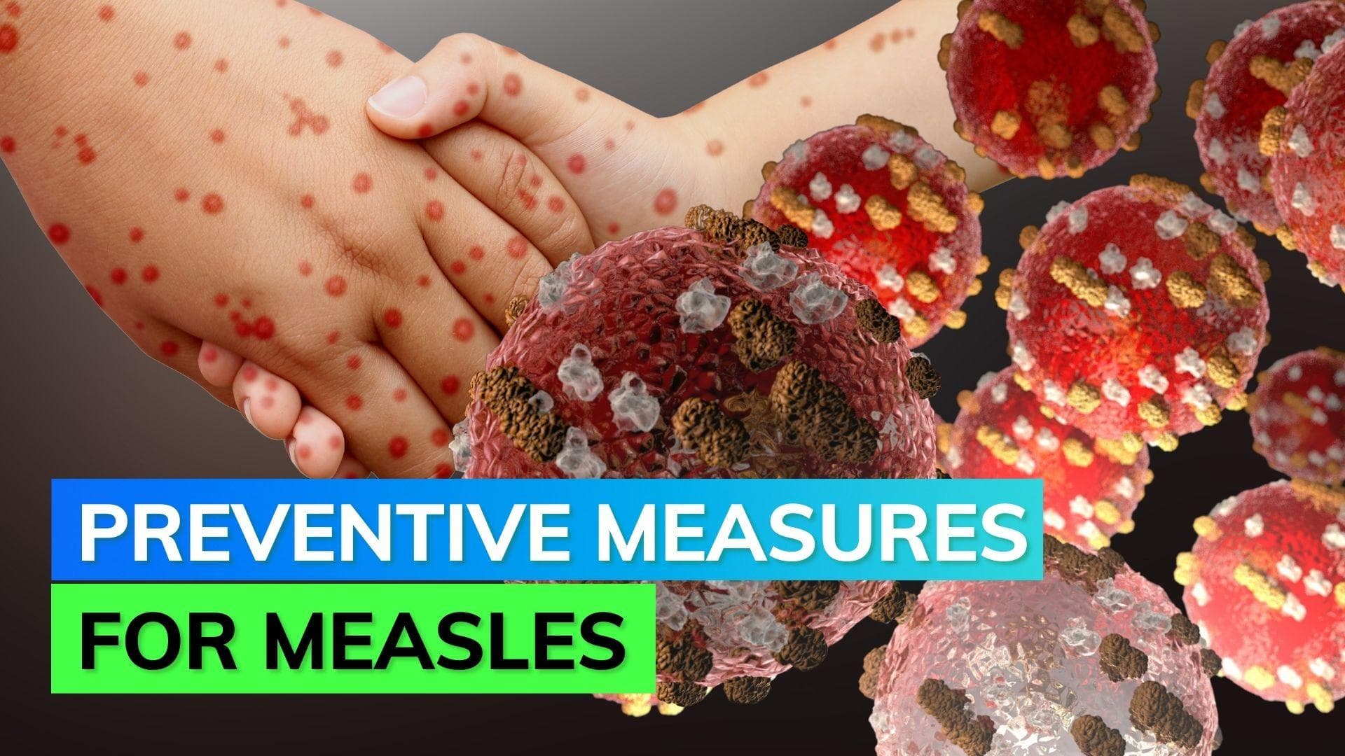 Measles outbreak in Mumbai: Recognise the symptoms and prevent your children from the contagious disease