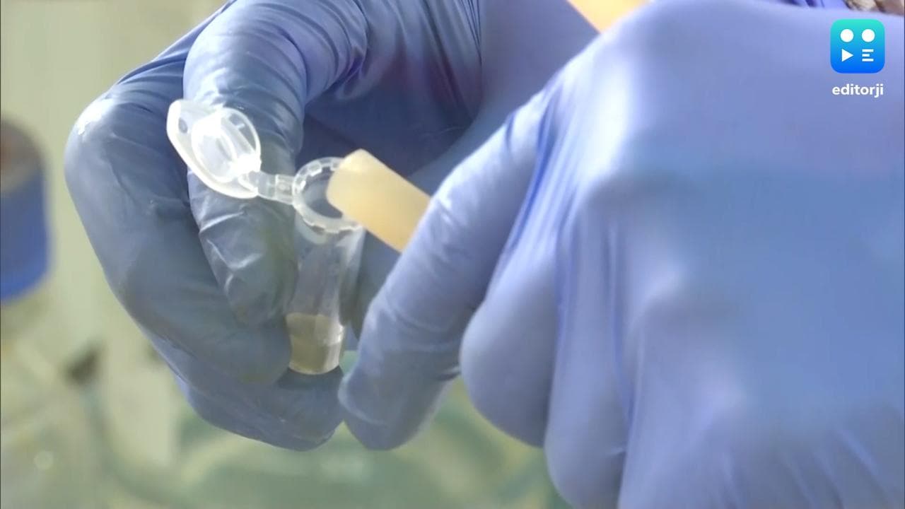 Snake Venom: সাপের বিষের প্রতিষেধক এবার ট্যাবলেট, ট্রায়াল শুরু হচ্ছে কলকাতা ন্যাশনাল মেডিক্যাল কলেজে