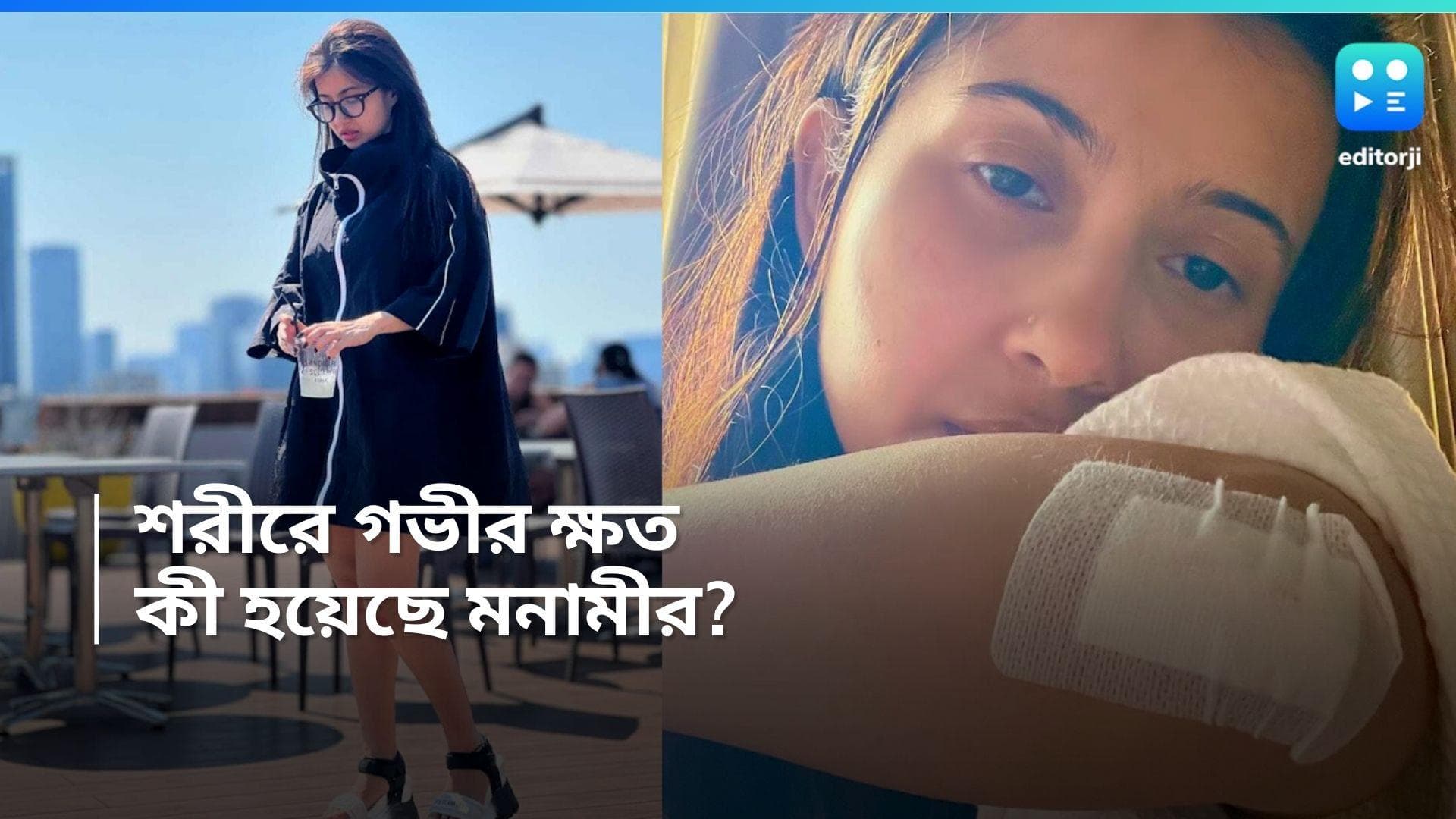 Monami Ghosh: হাঁটুতে কাটা ছেঁড়া, কনুইয়ে গভীর ক্ষত! কী হয়েছে মনামীর?