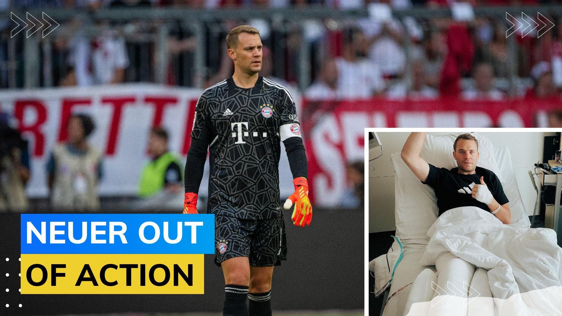 Germany & Bayern Munich goalkeeper Manuel Neuer breaks his leg while on vacation