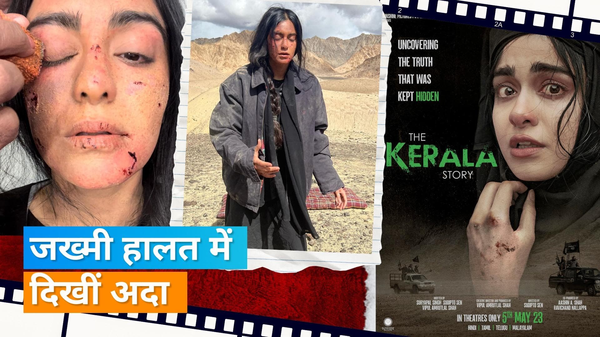 Adah Sharma ने फटे होठ और चोट से जख्मी तस्वीर की शेयर, 40 घंटे बिना पानी पीए अफगानिस्तान में की थी शूटिंग