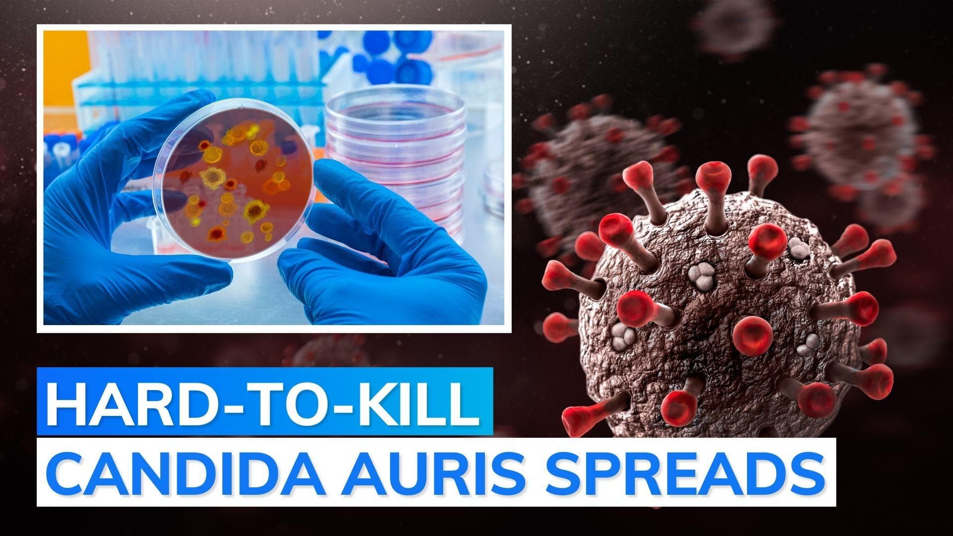 USA: deadly fungal infection cases rising; up 4,300% in 6 yrs