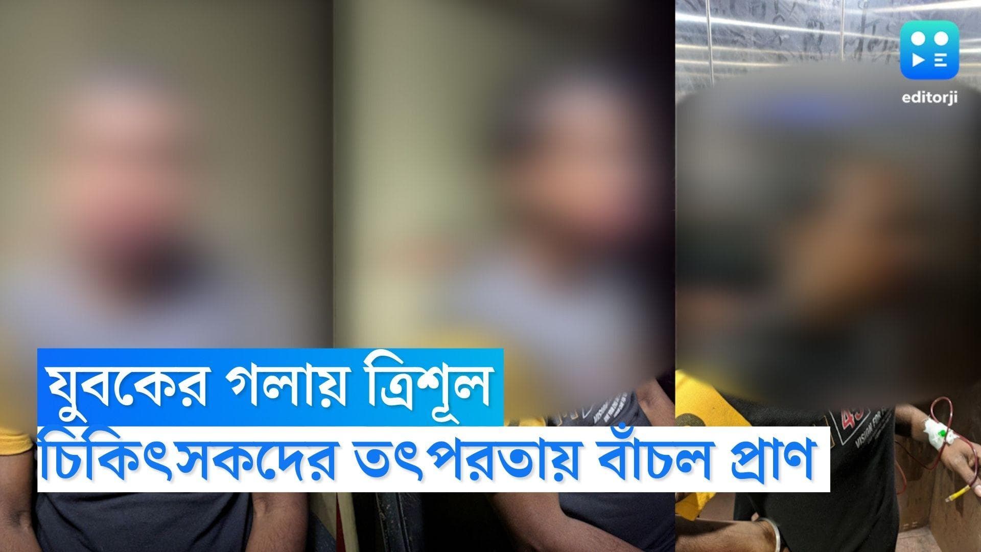 NRS News: গলায় ত্রিশূল এফোঁড় ওফোঁড়, চিকিৎসকদের তৎপরতায় প্রাণে বাঁচল যুবক