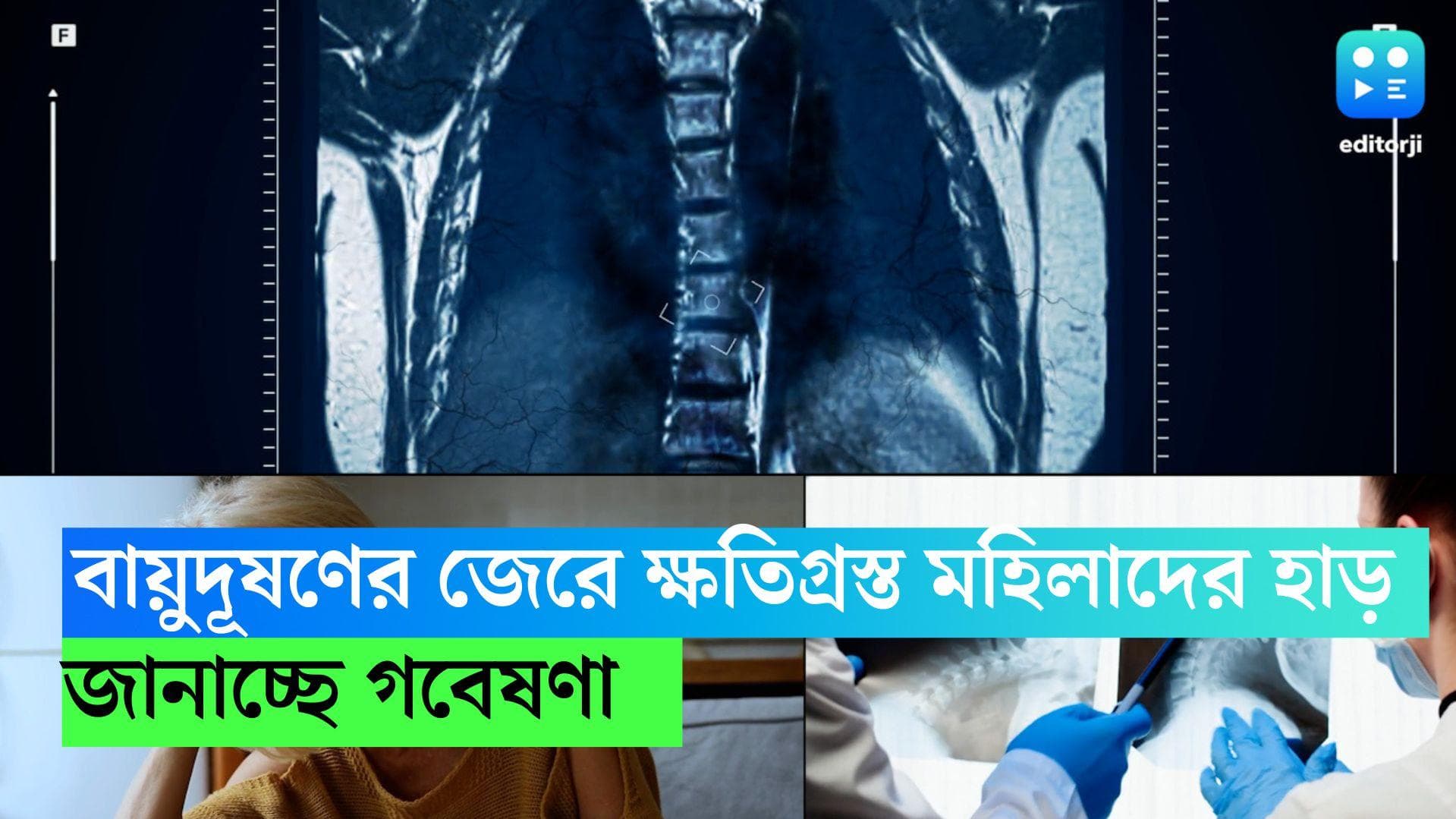 Menopausal women: মেনোপজের পর মহিলাদের শরীরে হাড়ের সবথেকে বেশি ক্ষতি করে বায়ুদূষণ, জানাচ্ছে গবেষণা