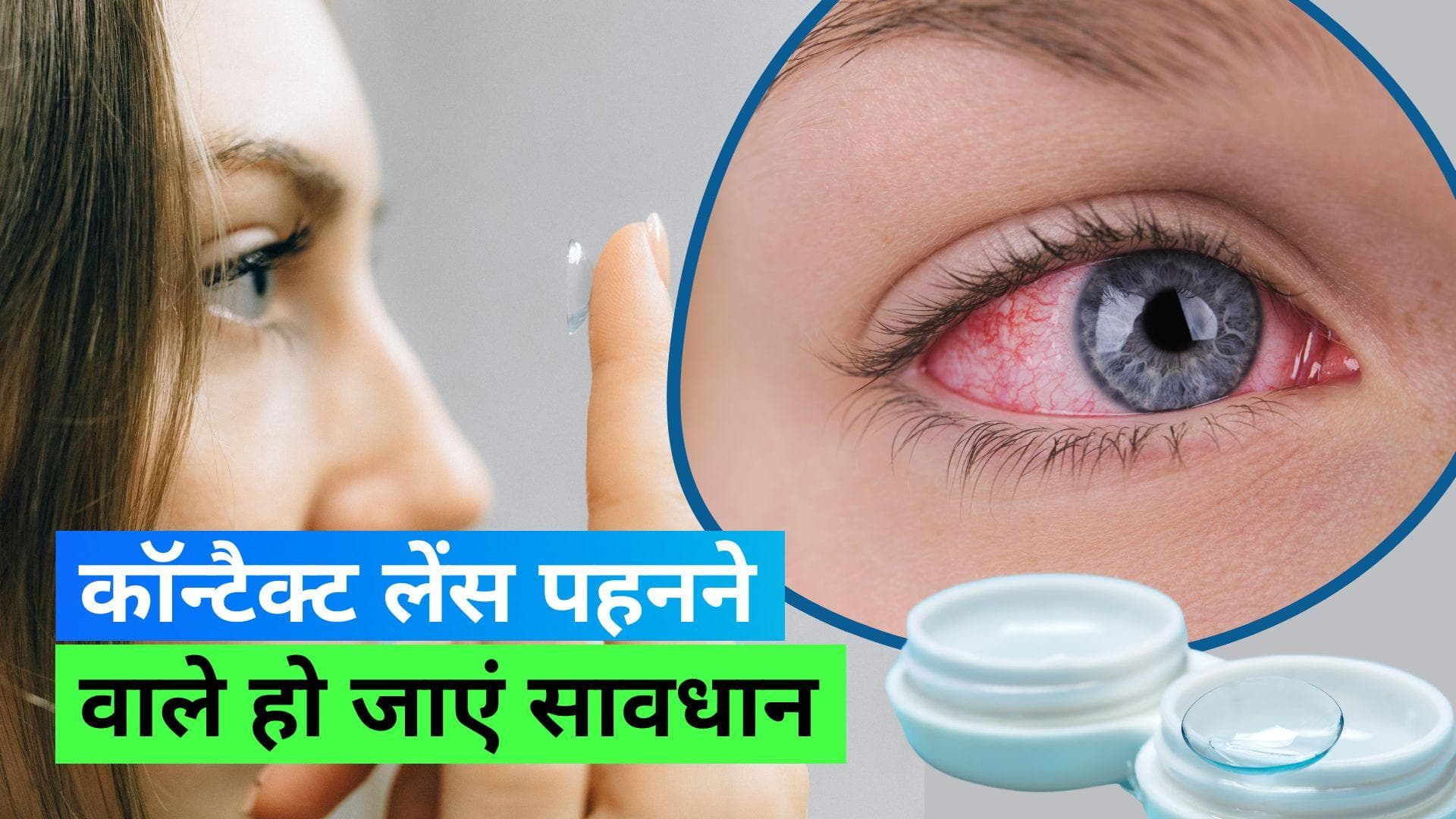 Contact Lenses Tips: कॉन्टैक्ट लेंस पहनते हैं तो हो सकता है आई इन्फेक्शन, बचने के लिए फॉलो करें 7 टिप्स