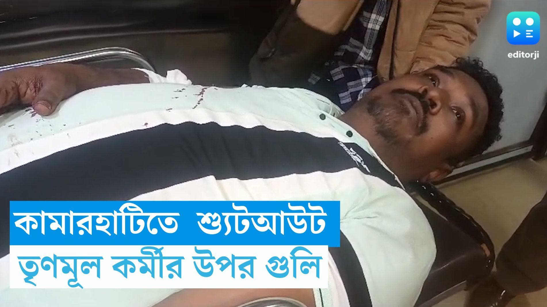 Kamarhati Shootout: কামারহাটিতে শ্যুটআউট, গুলিবিদ্ধ এক তৃণমূল কর্মী 