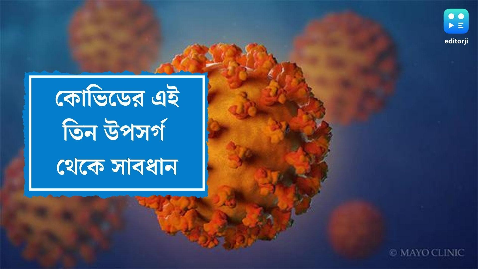 Covid-19 Symptoms: কোভিডের এই তিনটি নতুন উপসর্গ থেকে সাবধান, জানাল জাতীয় স্বাস্থ্য পরিষেবা