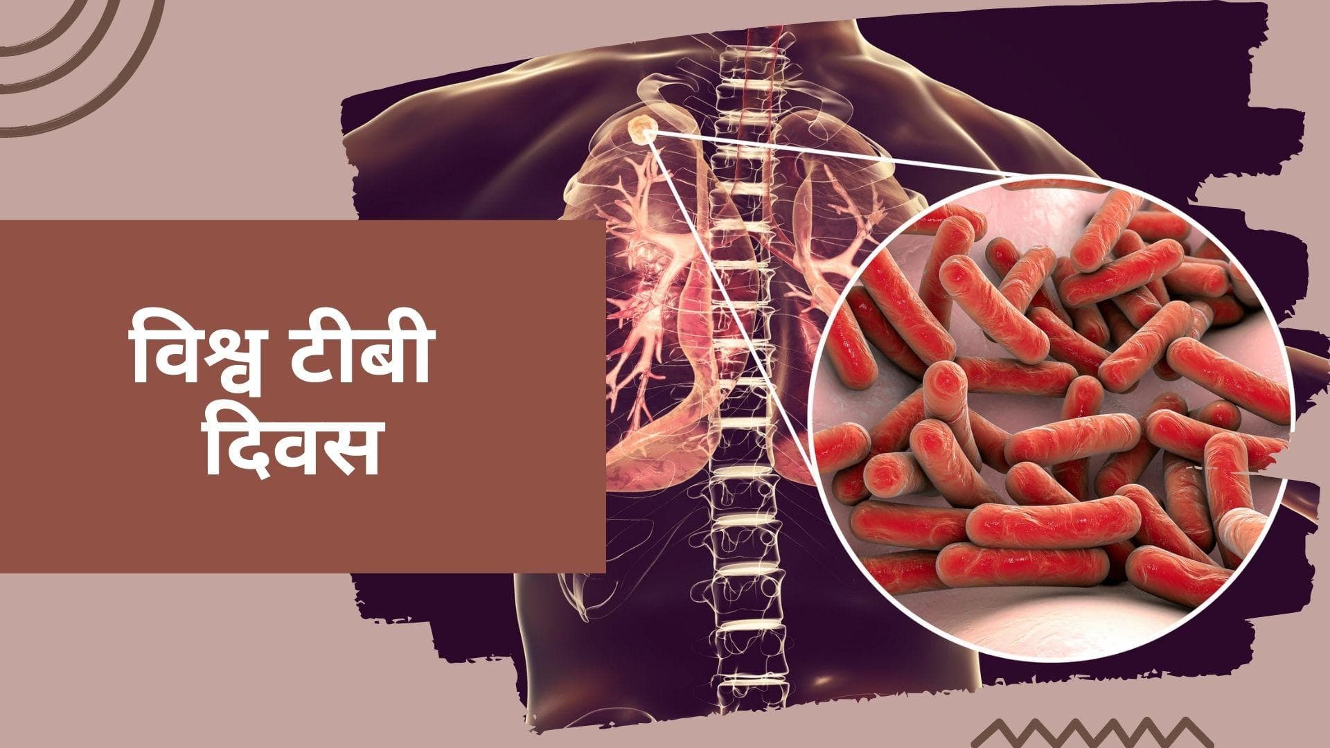 World Tuberculosis Day 2022: टीबी से हर रोज़ 4 हज़ार लोगों की जाती है जान, जानिये क्या है जानलेवा बीमारी