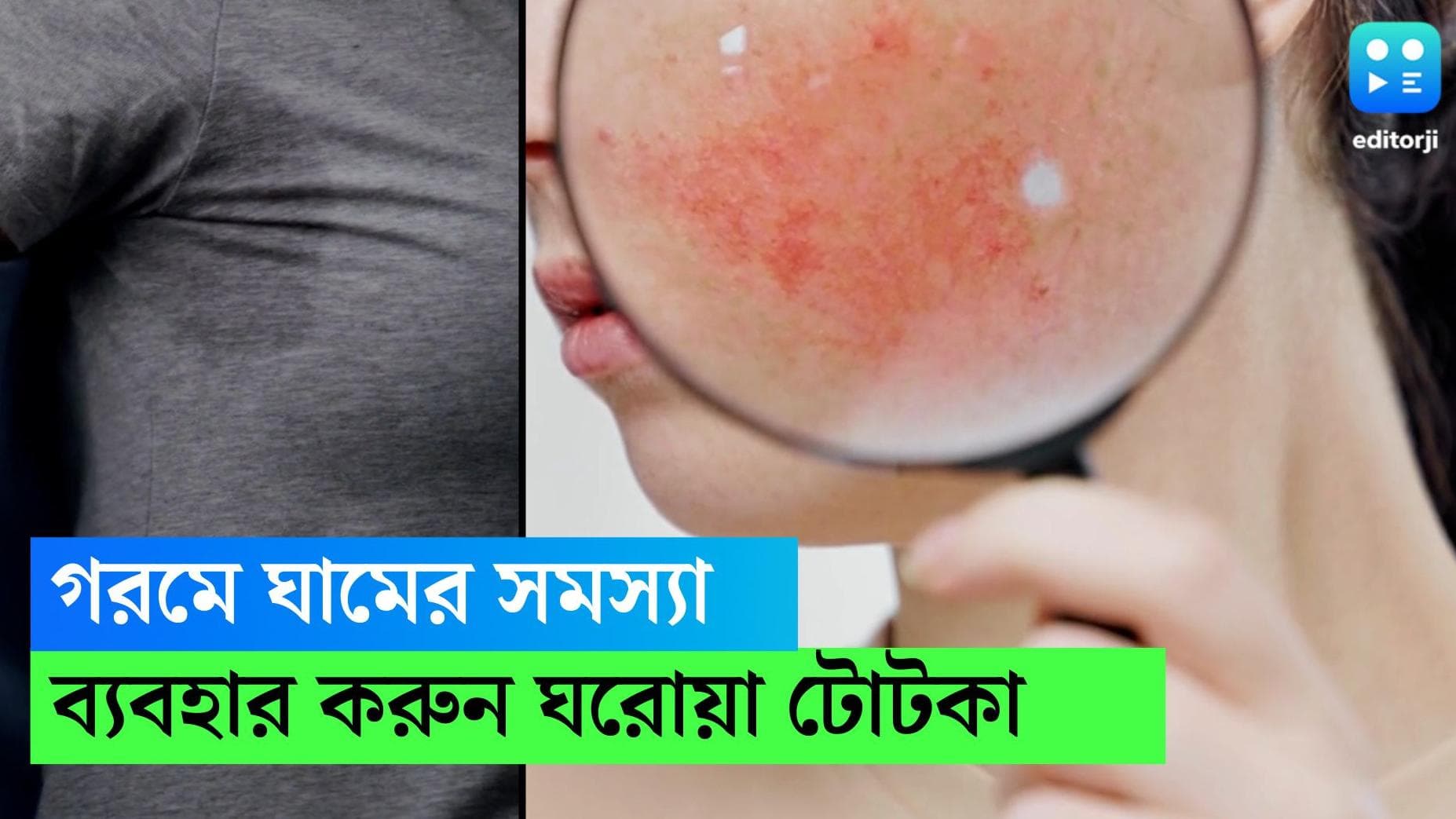 Home remedies for sweat problems: প্রবল গরমে ঘামের সমস্যায় জেরবার, সমাধান হিসেবে রইল কিছু ঘরোয়া টোটকা 