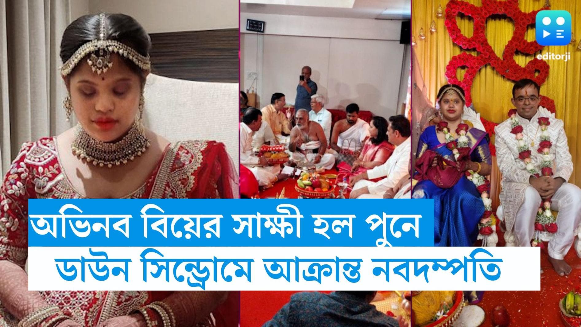 Down syndrome couple marriage: দু'জনেরই 'ডাউন সিন্ড্রোম', হাতে হাত রেখে পথ চলা শুরু নব বিবাহিত যুগলের