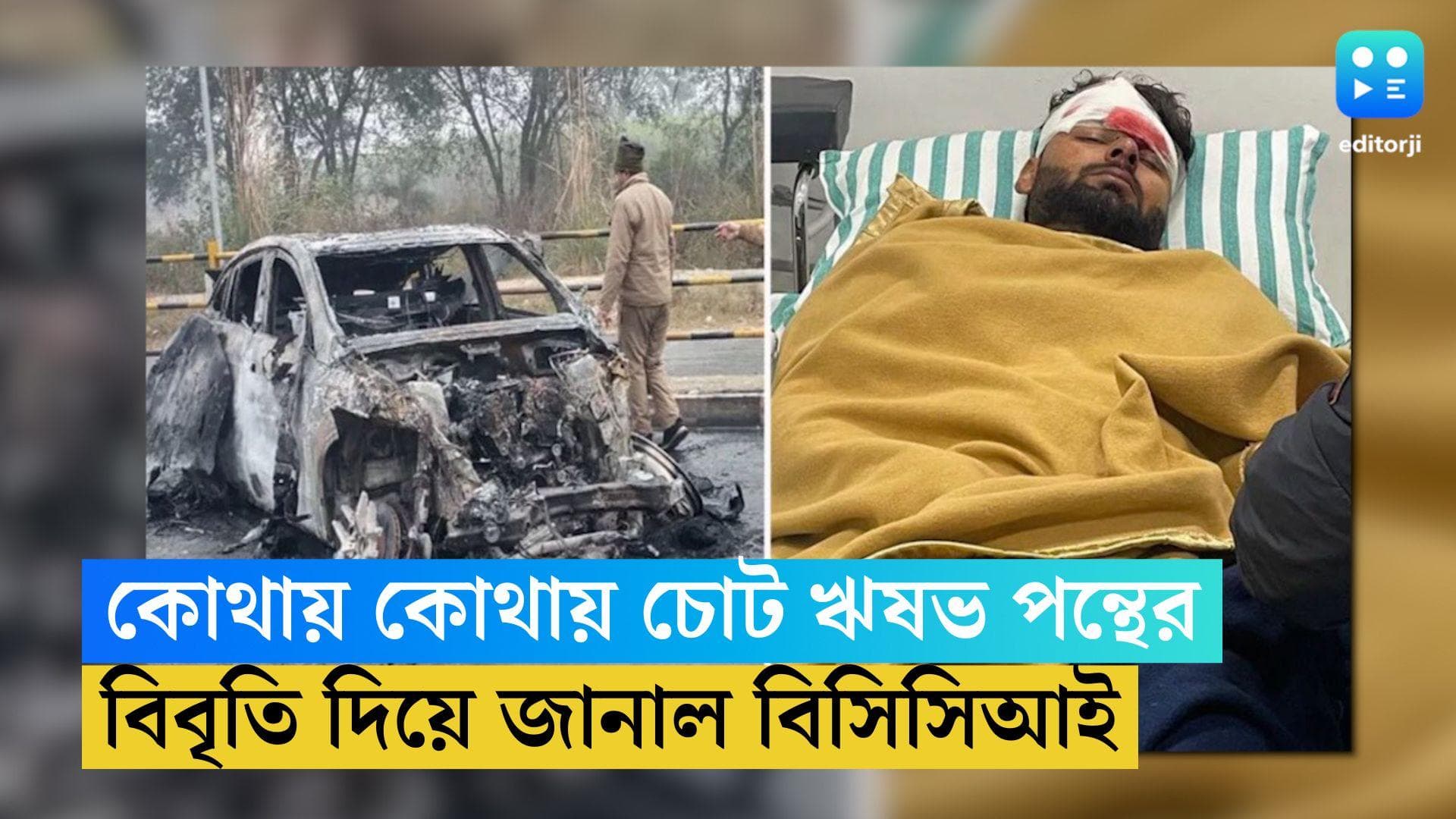 Rishabh Pant Accident: কোথায় কোথায় চোট ঋষভ পন্থের, বিবৃতি দিয়ে জানাল বিসিসিআই