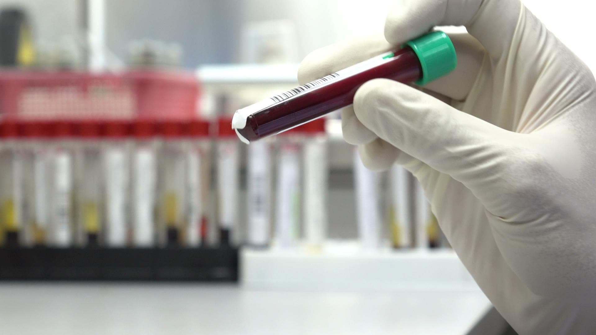 जल्द ही ब्लड टेस्ट से लगेगा अल्जाइमर्स का पता- वैज्ञानिकों का दावा