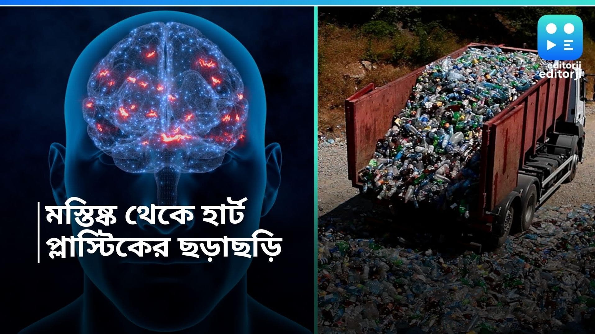 Microplastics: হৃদযন্ত্র, মগজ সর্বত্র ঢুকে গিয়েছে প্লাস্টিক, ঘটাচ্ছে মারাত্মক রোগ! 
