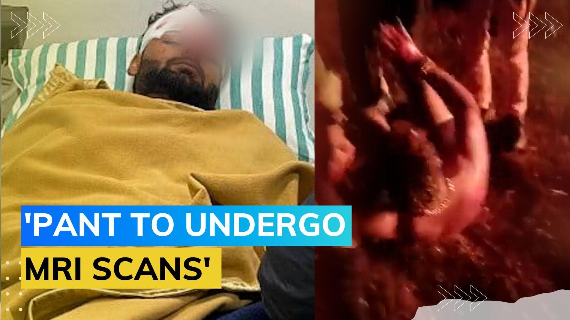 Rishabh Pant car accident: BCCI reveals details of Pant's injuries