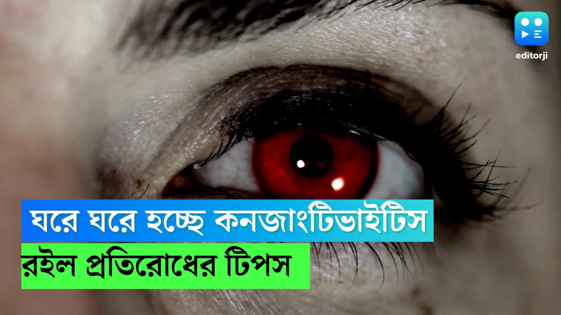Monsoon Health Tips : ঘরে ঘরে হচ্ছে কনজাংটিভাইটিস, রোগের লক্ষণ কী ? রইল প্রতিরোধের টিপসও