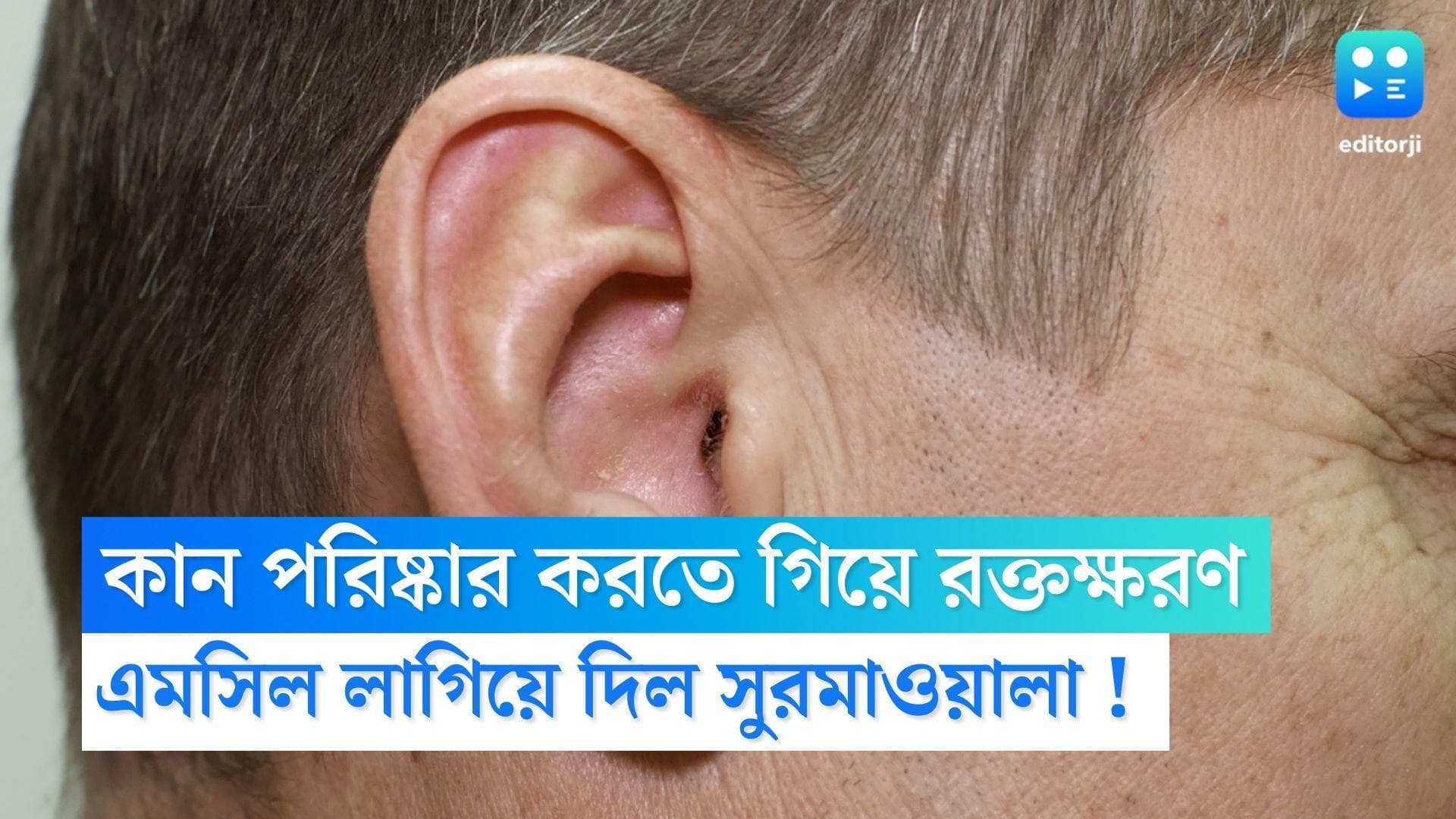 Katwa News : কান থেকে রক্ত পড়া বন্ধ করতে এমসিল ! চাঞ্চল্যকর ঘটনা পূর্ব বর্ধমানে