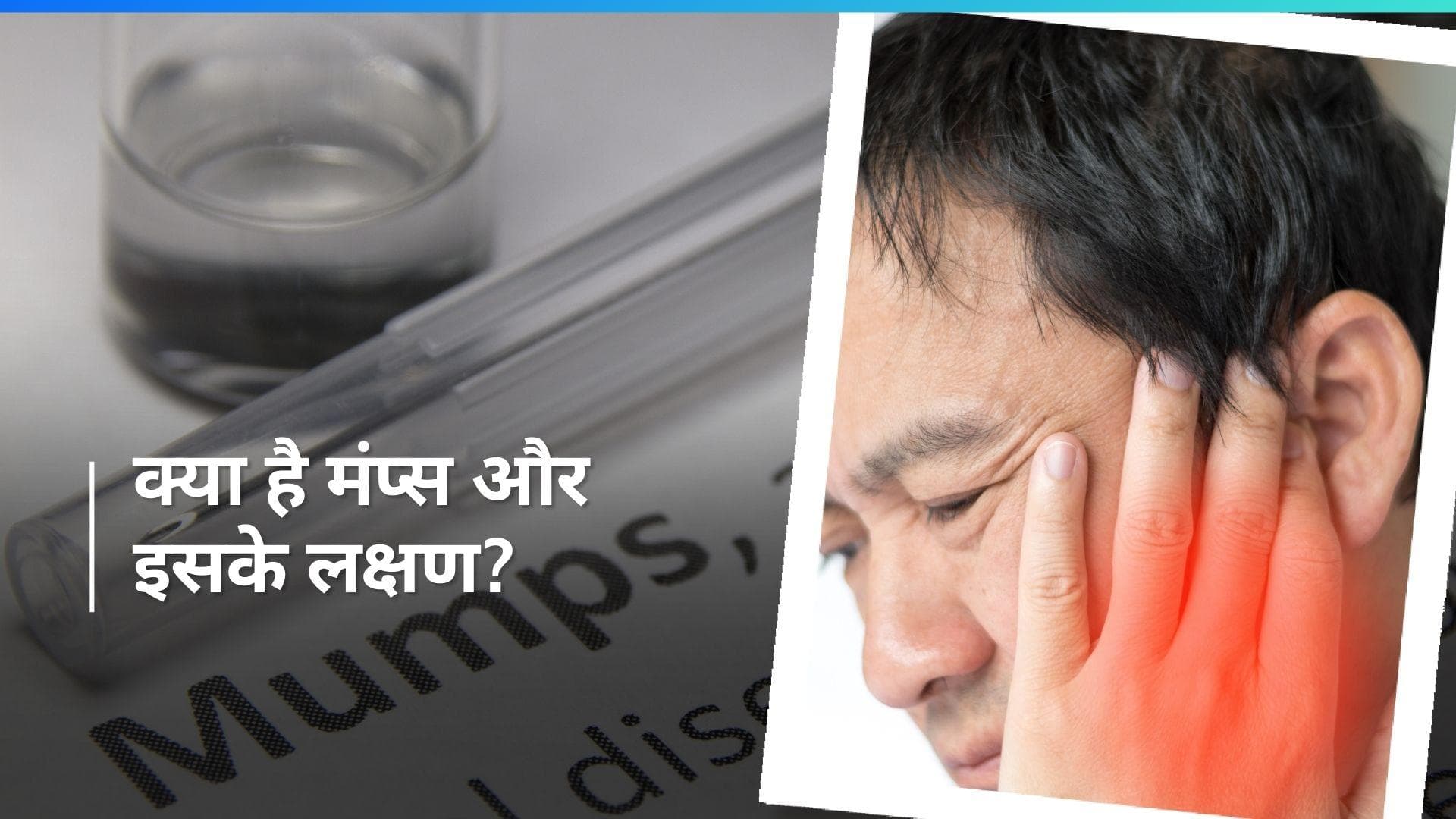 Mumps in Delhi: अब दिल्ली एनसीआर में भी मंप्स का प्रकोप, बच्चों में तेज़ी से बढ़ रही है ये बीमारी