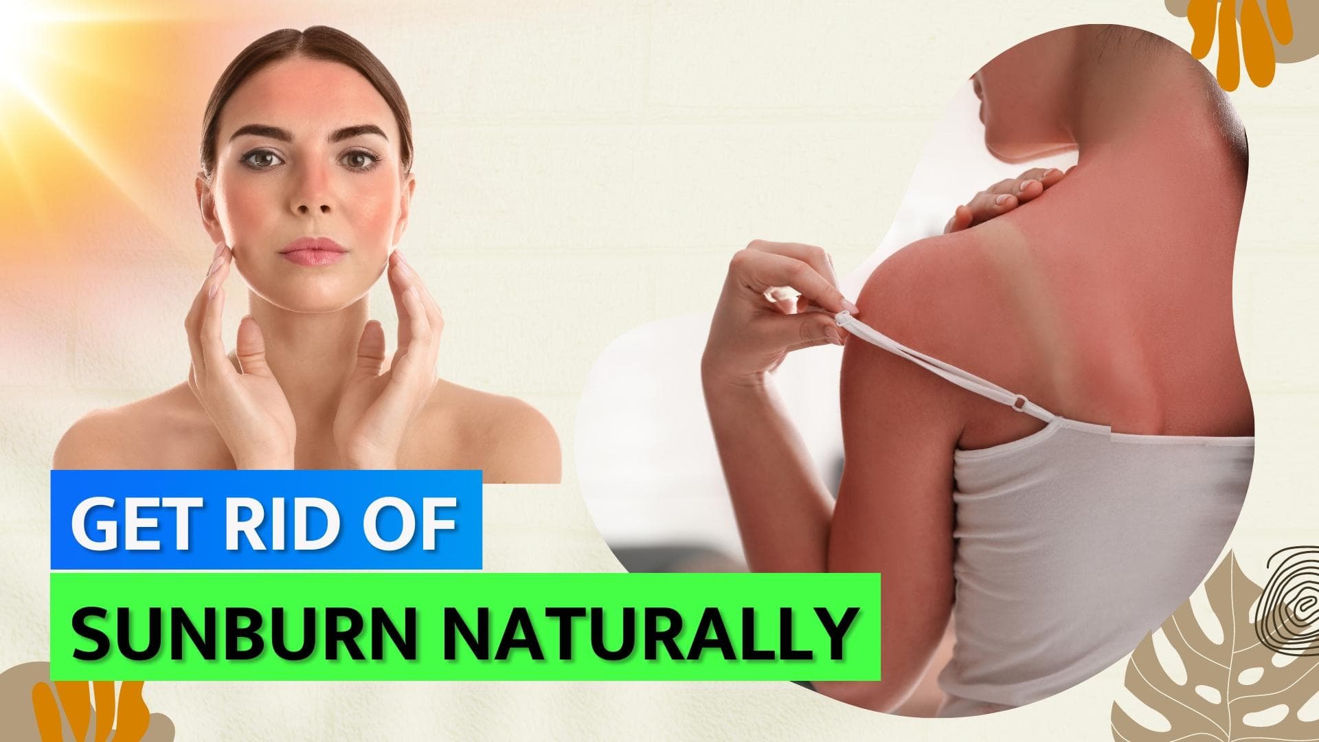 Heal sunburns and heat rashes easily at home with these remedies