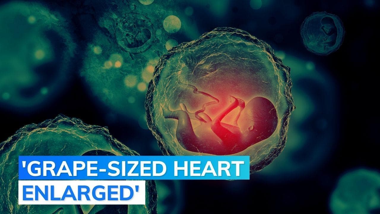 Delhi: AIIMS cardiologists perform successful heart surgery on foetus