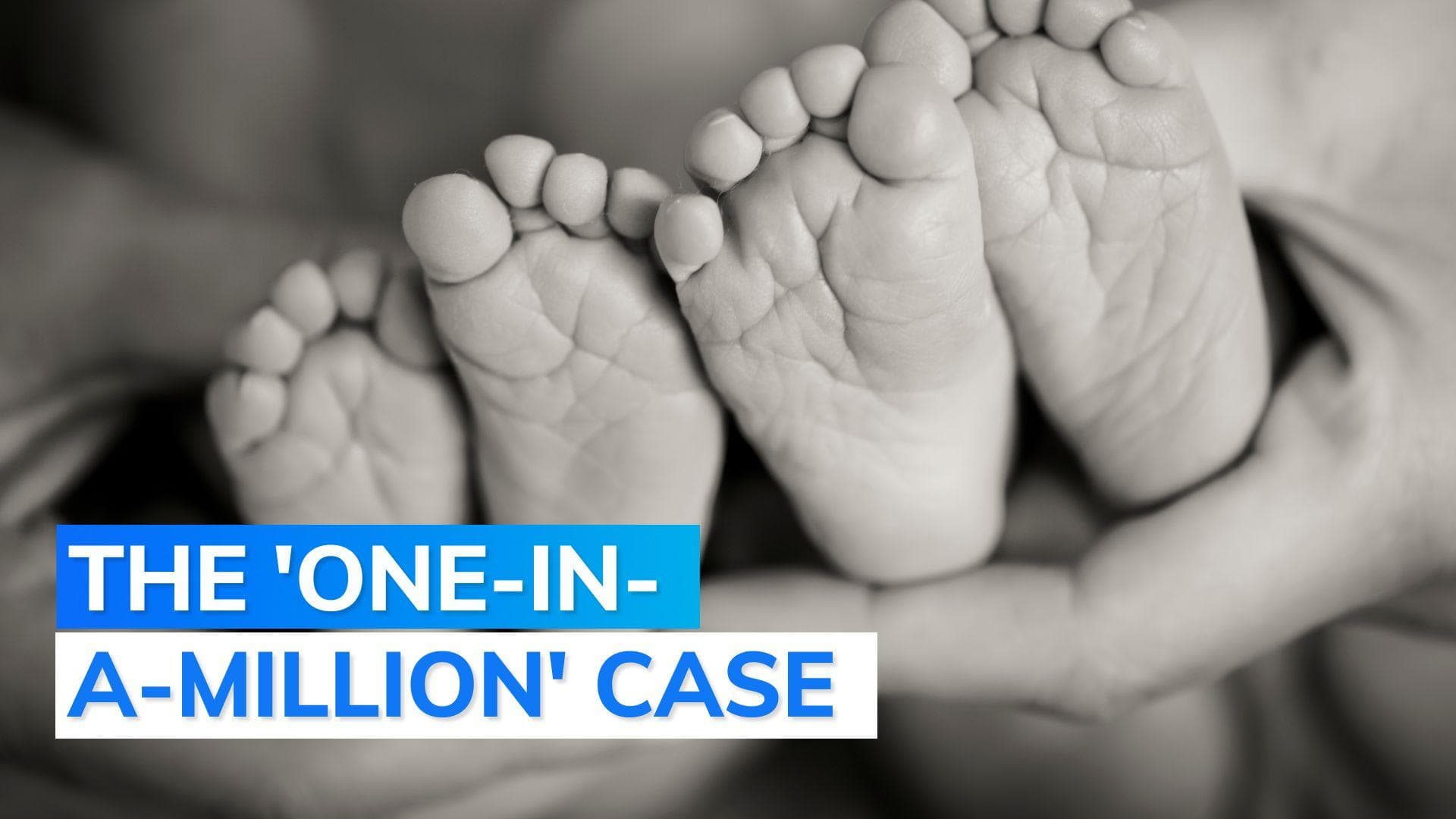  Brazil: Teen gives birth to twins from different fathers in a super rare conception