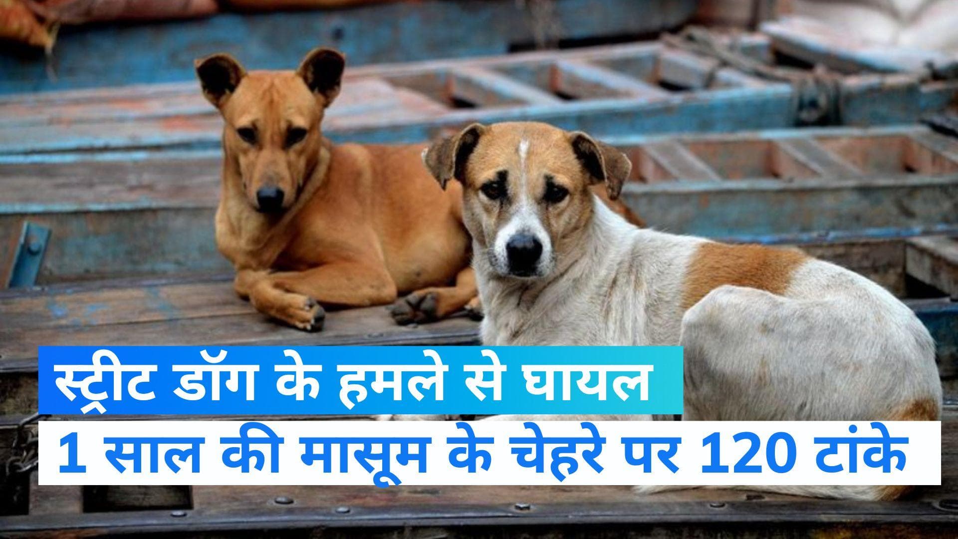 Ghaziabad Dog Attack: स्ट्रीट डॉग ने किया था हमला... 1 साल की मासूम के चेहरे पर लगे 120 टांके