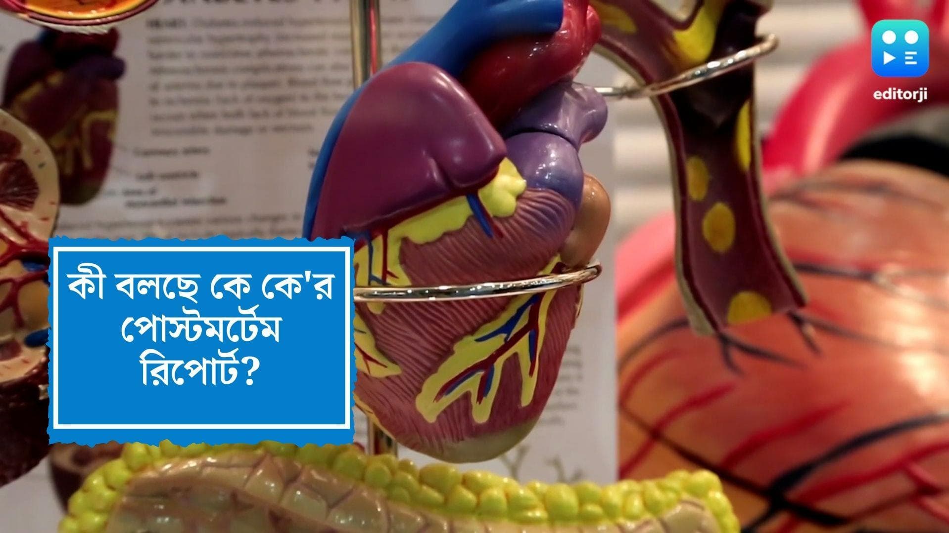 Kk's Death cause: ময়নাতদন্তের রিপোর্ট বলছে, কেকে-র মৃত্যুর কারণ, মায়োকার্ডিয়াল ইনফার্কশন, জানুন কী এই রোগ