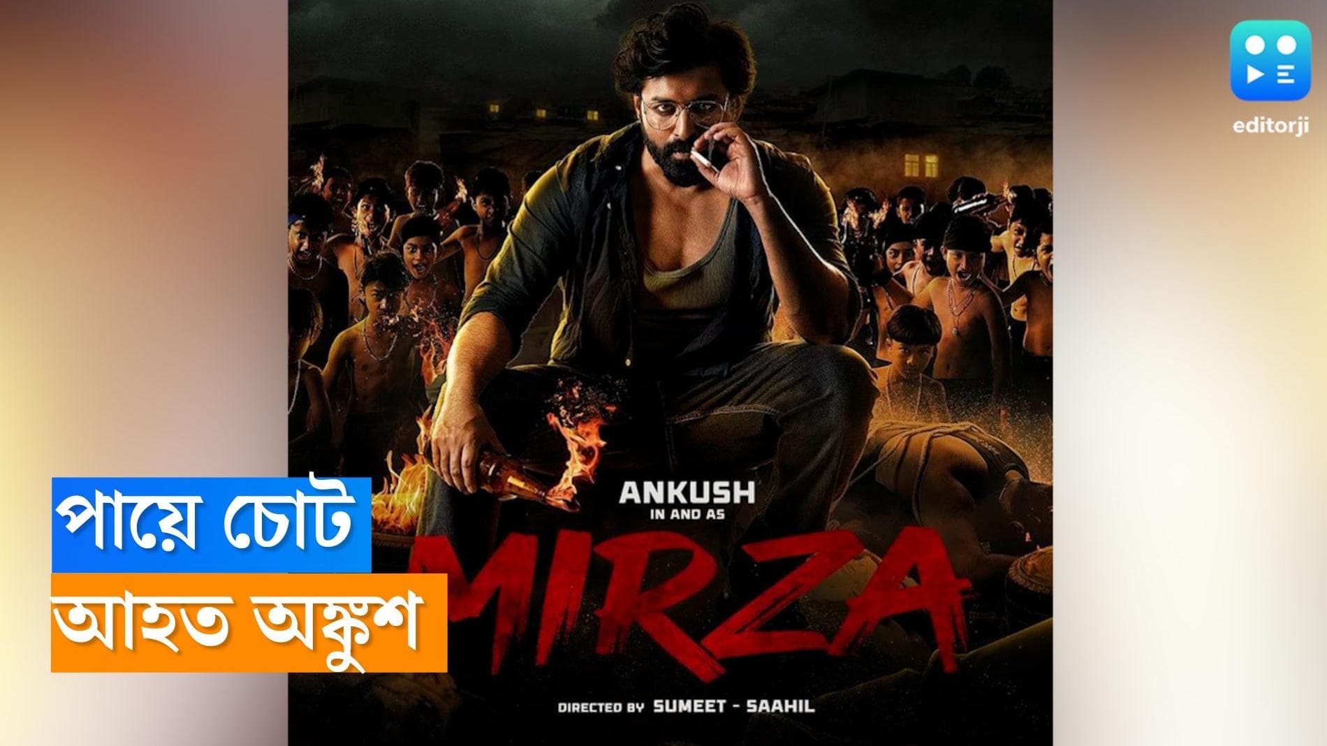 Ankush Hazra : নতুন বছরে পায়ে ব্যান্ডেজ, বিছানায় শুয়ে অঙ্কুশ, হঠাৎ কী হল অভিনেতার ?