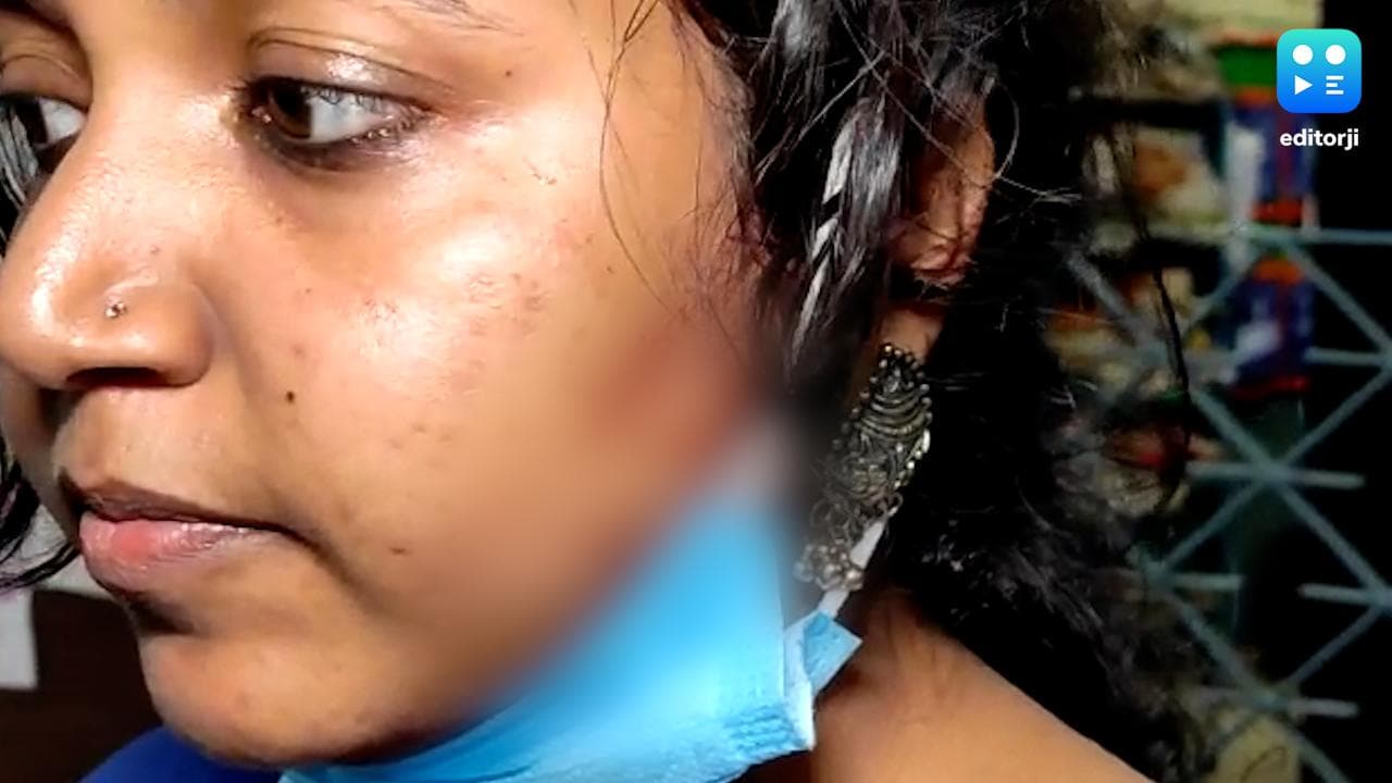 Sonarpur News: দাবি মেনে টাকা দিতে অস্বীকার, ট্রেনে ভাই-বোনকে বেধড়ক মারধরের অভিযোগ বৃহন্নলাদের বিরুদ্ধে