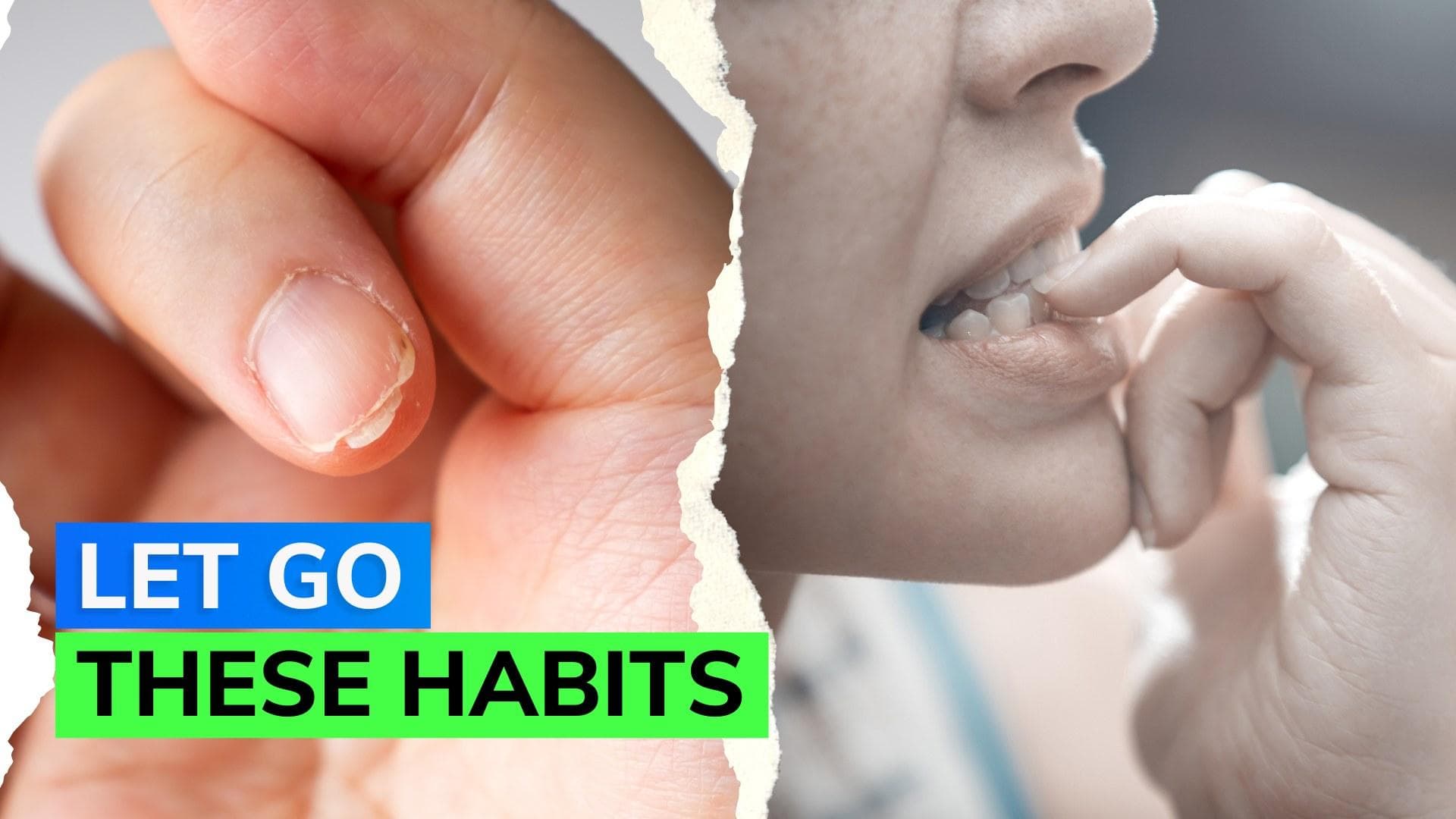 Nail Biting: Groundbreaking research may finally cure repetitive habits