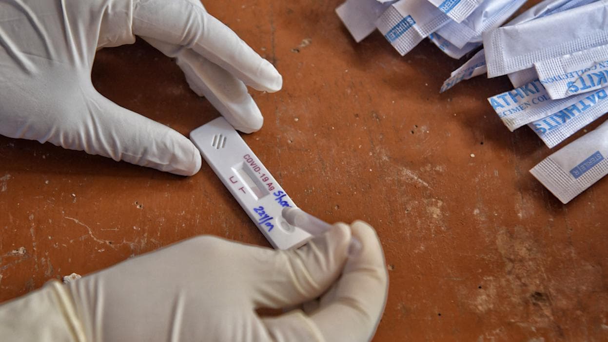 West Bengal Covid: রাজ‍্যের করোনায় তিরিশের উপরেই মৃত‍্যু সংখ‍্যা, দৈনিক সংক্রমণ বেড়ে ৯১৯১