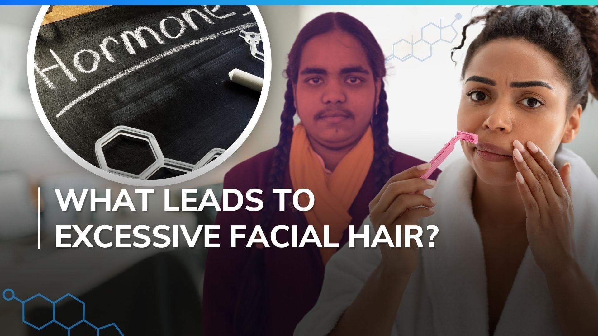 UP 10th board topper faces trolling. Know why some women have excessive facial hair 